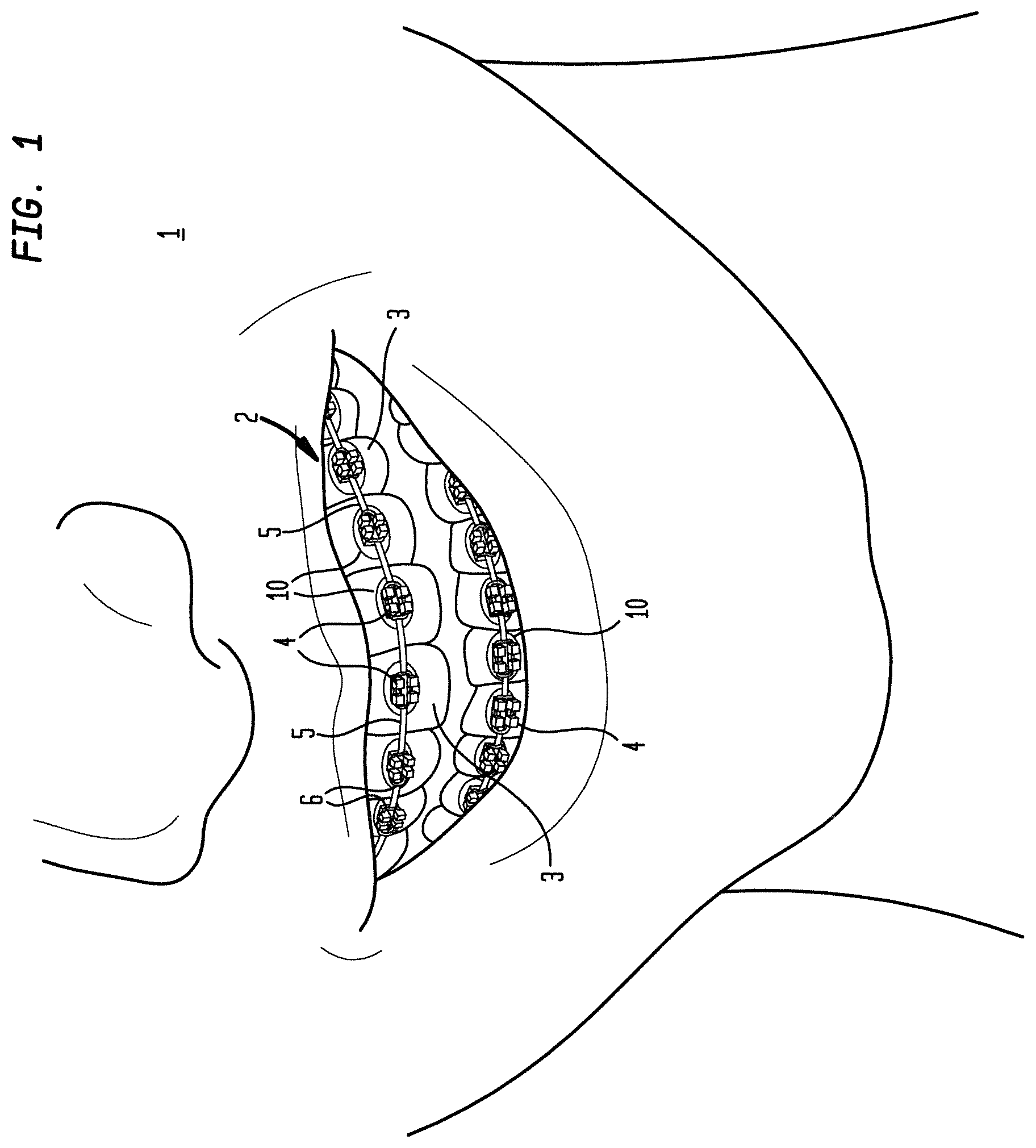 Patent US12090024 — Bracket system — Figure 1