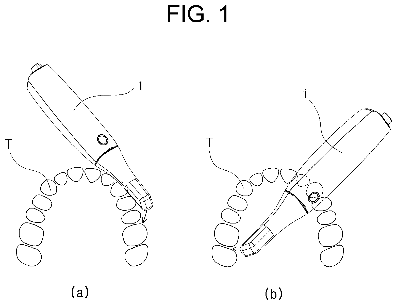 Patent US12090026 — Three-dimensional intraoral scanner — Figure 1