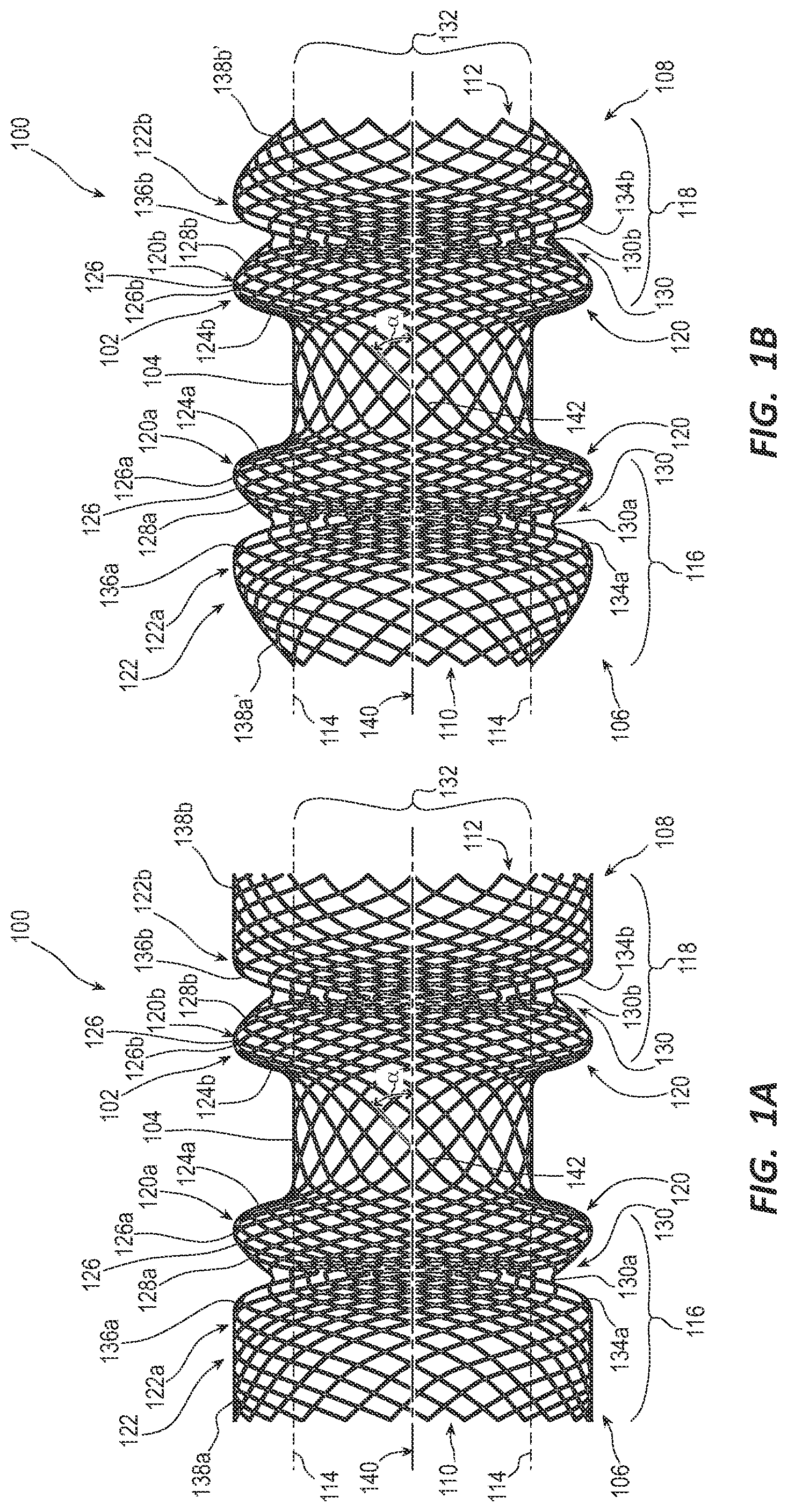 Patent US12090038 — Esophageal stents and related methods — Figure 1