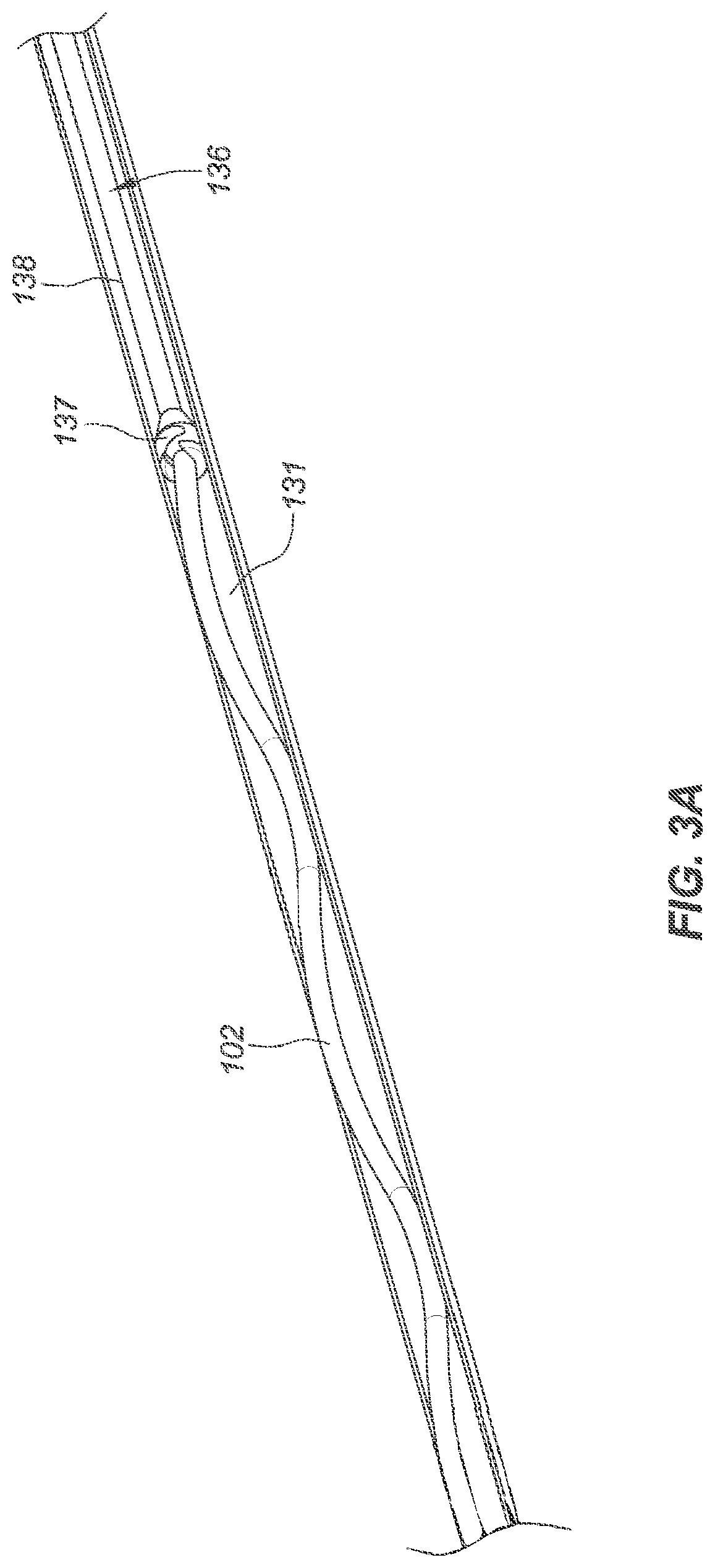 Patent US12090040 Figure 7 – Methods for deployment of an implant