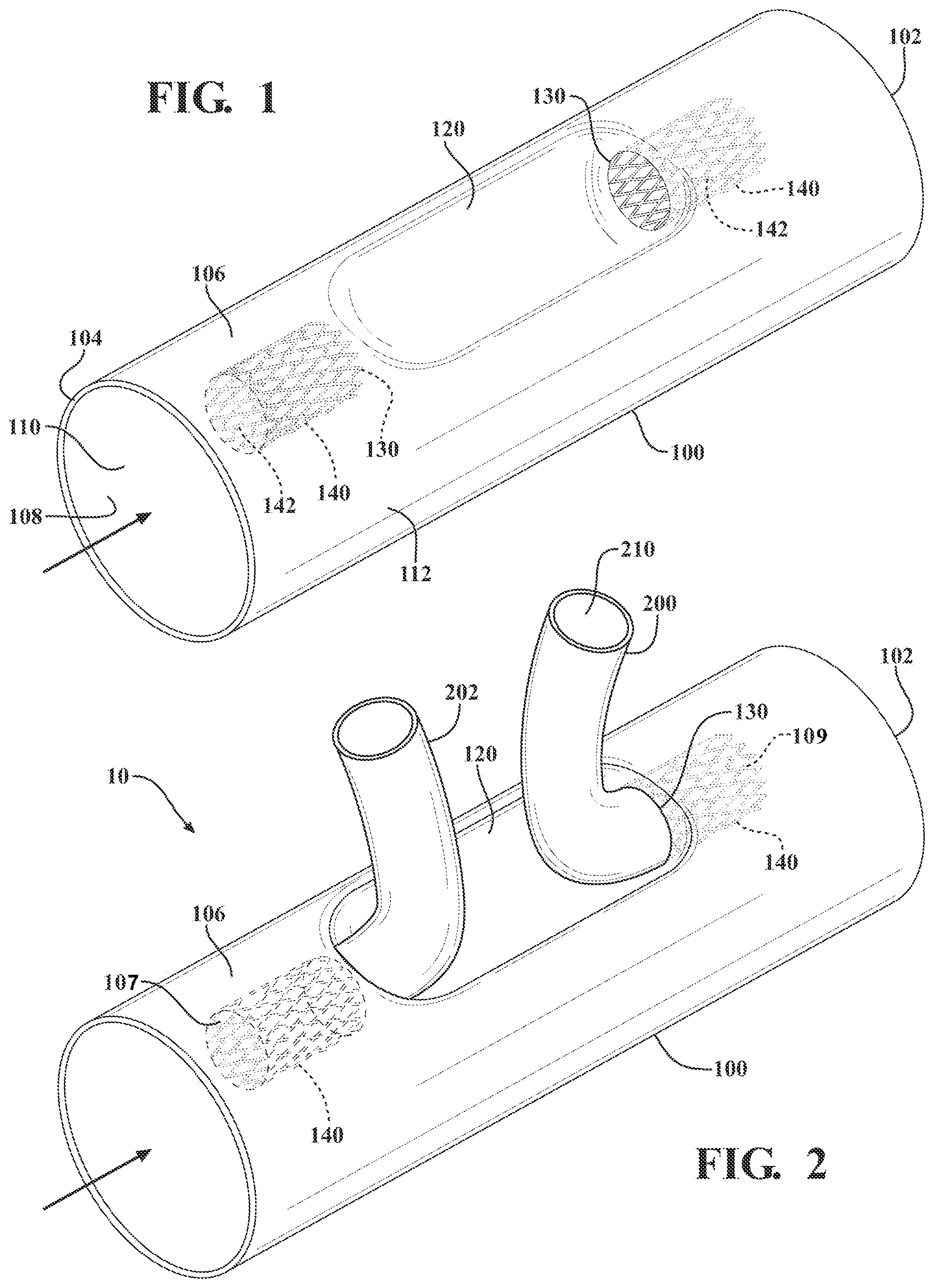 Patent US12090041 — Branched stent graft device and deployment — Figure 1