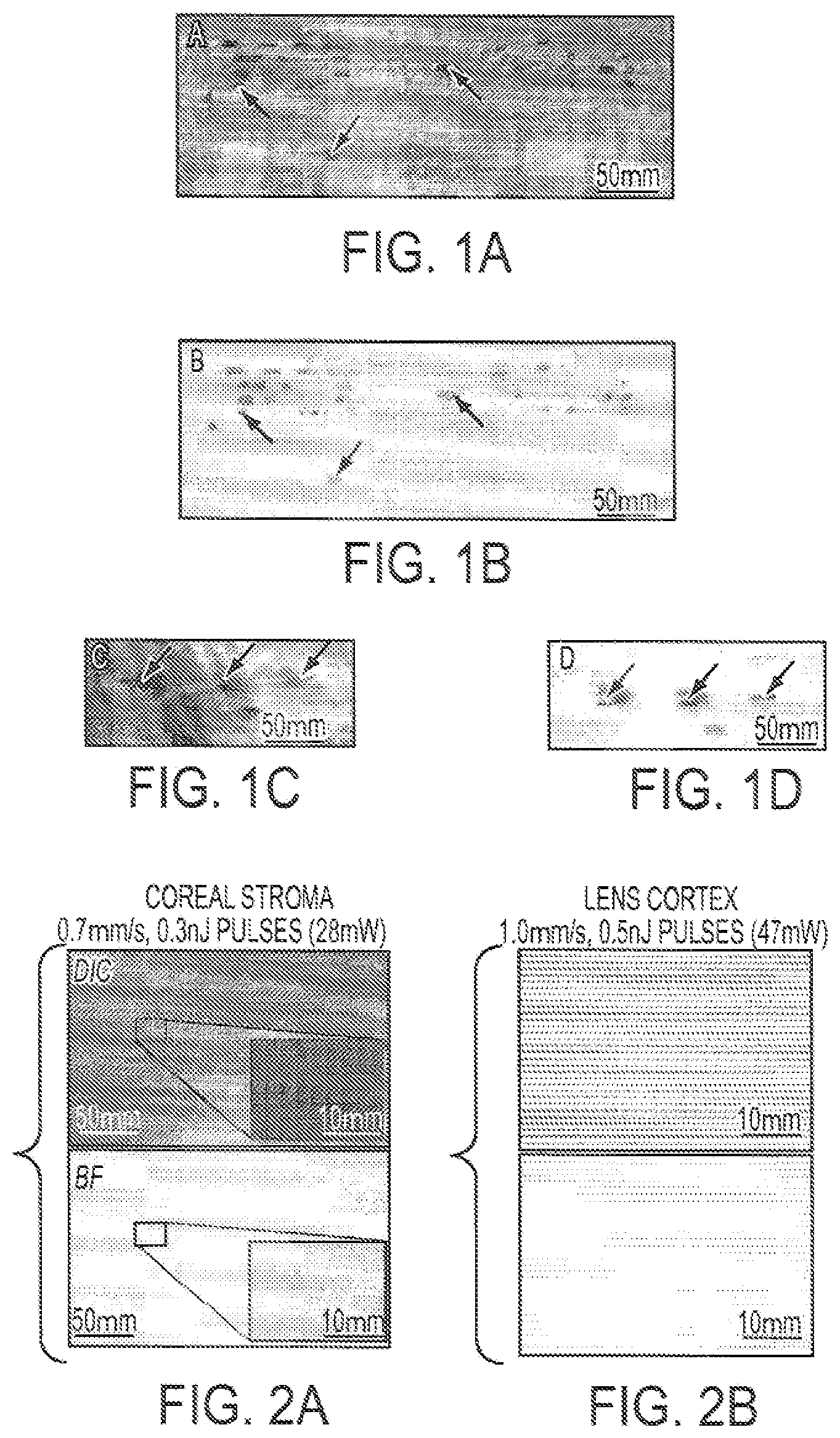 Patent US12090043 — Vision correction with laser refractive index changes — Figure 1