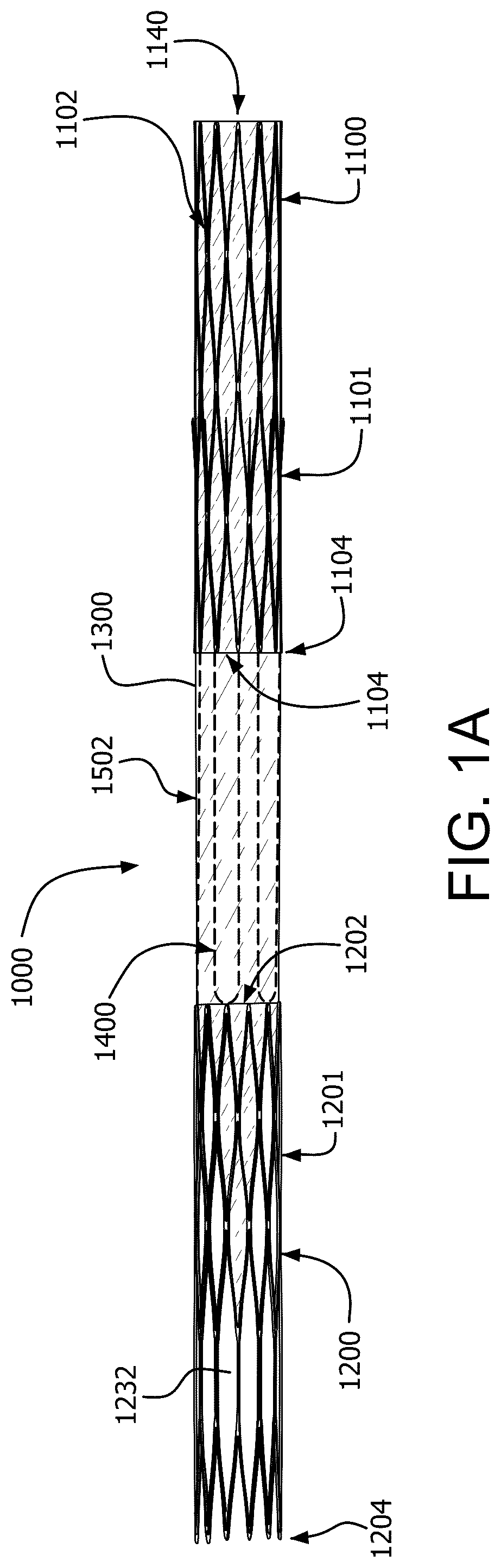Patent US12090046 — Telescoping prosthetic valve with retention element — Figure 1