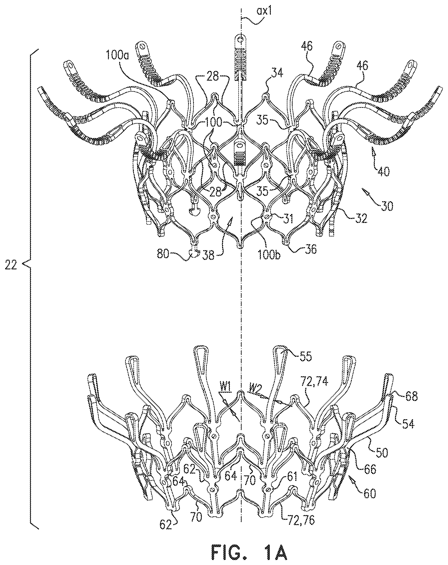 Patent US12090048 — Prosthetic heart valve — Figure 1