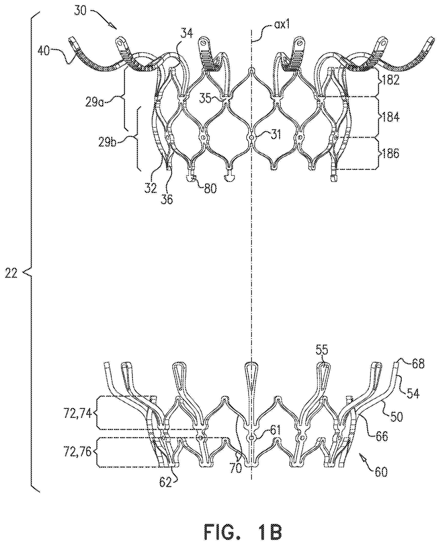 Patent US12090048 Figure 2 – Prosthetic heart valve