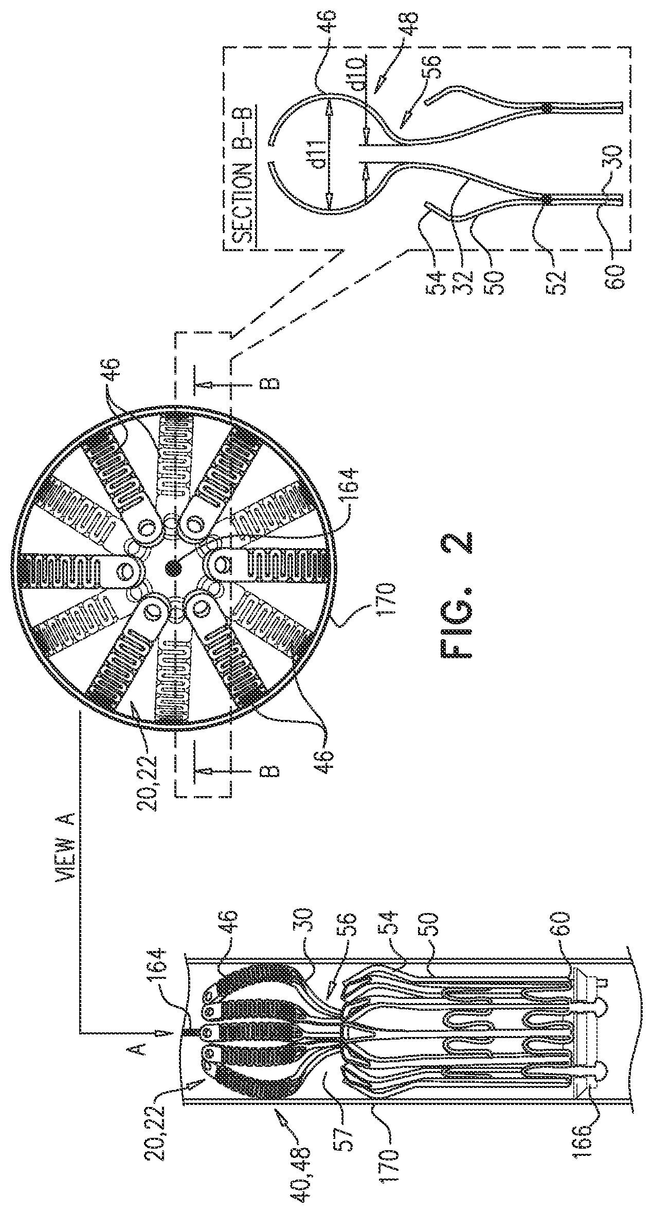 Patent US12090048 Figure 4 – Prosthetic heart valve