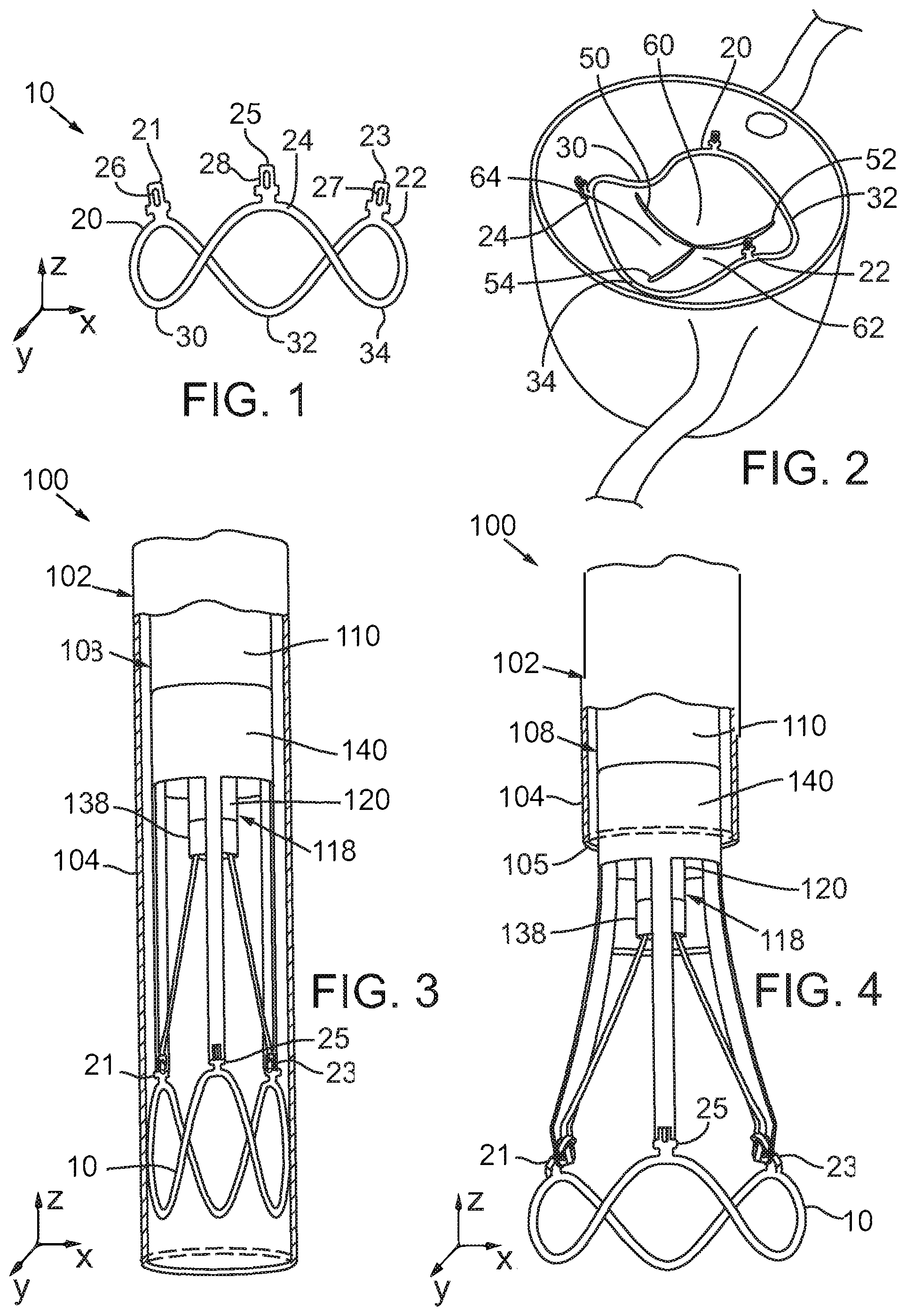 Patent US12090049 — Retaining mechanisms for prosthetic valves — Figure 1