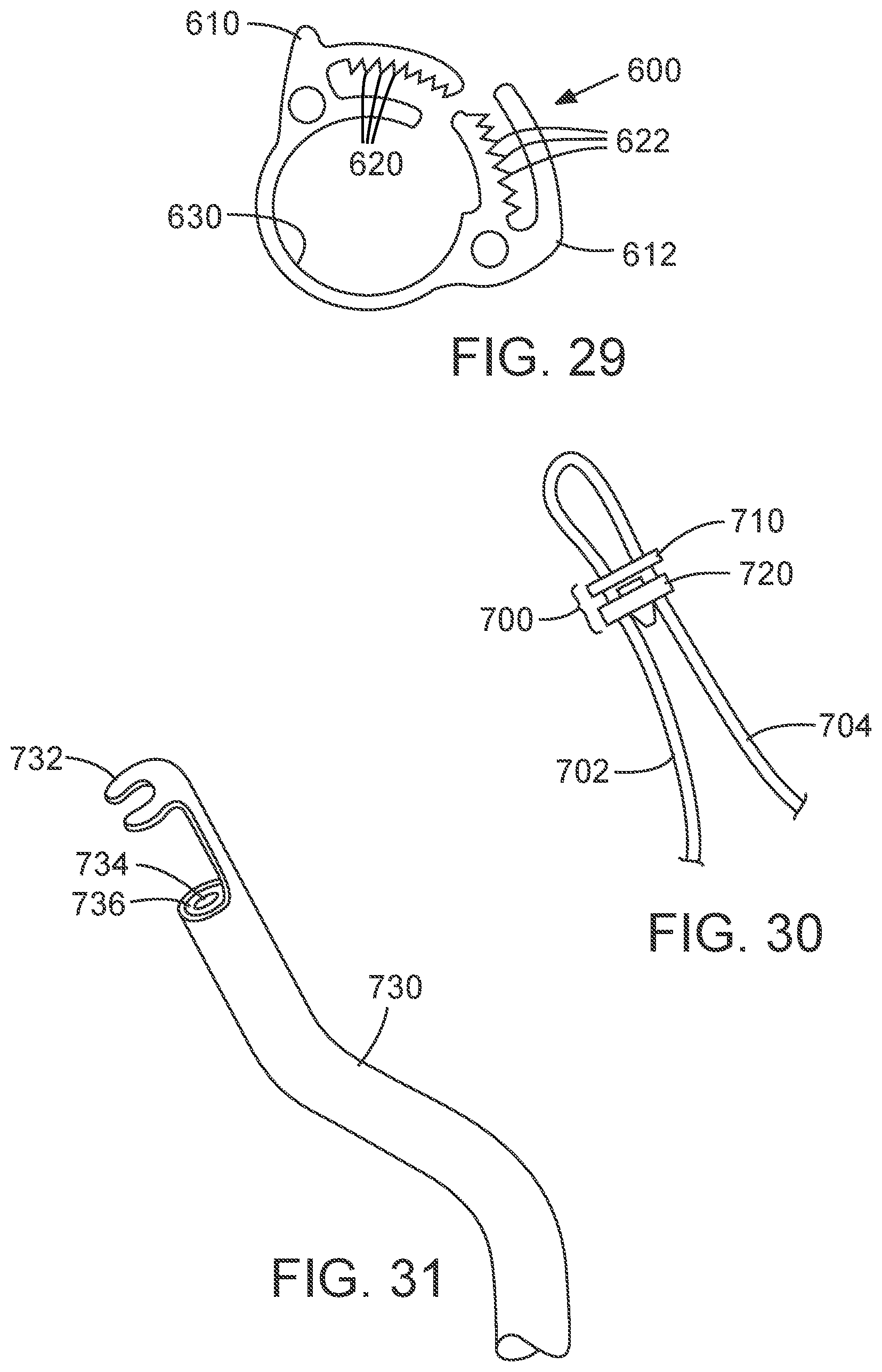Patent US12090050 Figure 16 – Method for delivering a support member to a native heart valve