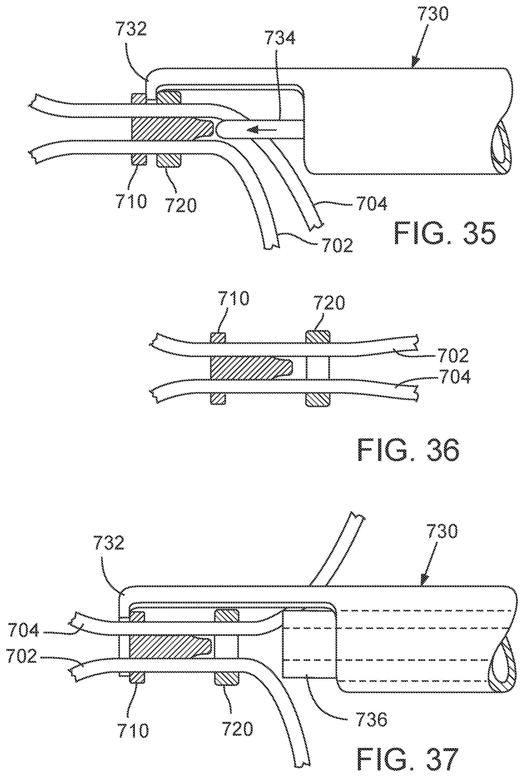 Patent US12090050 Figure 18 – Method for delivering a support member to a native heart valve