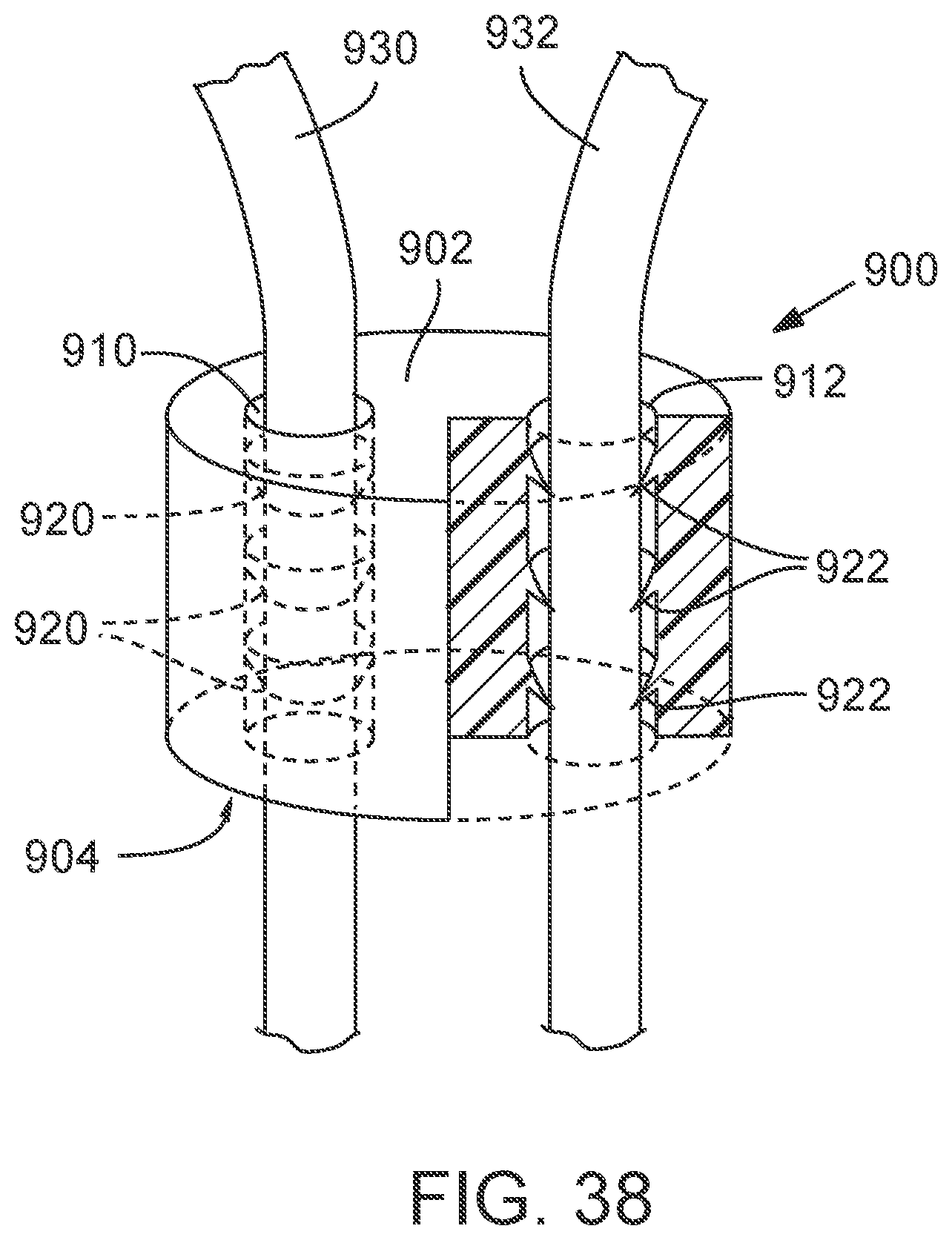 Patent US12090050 Figure 19 – Method for delivering a support member to a native heart valve