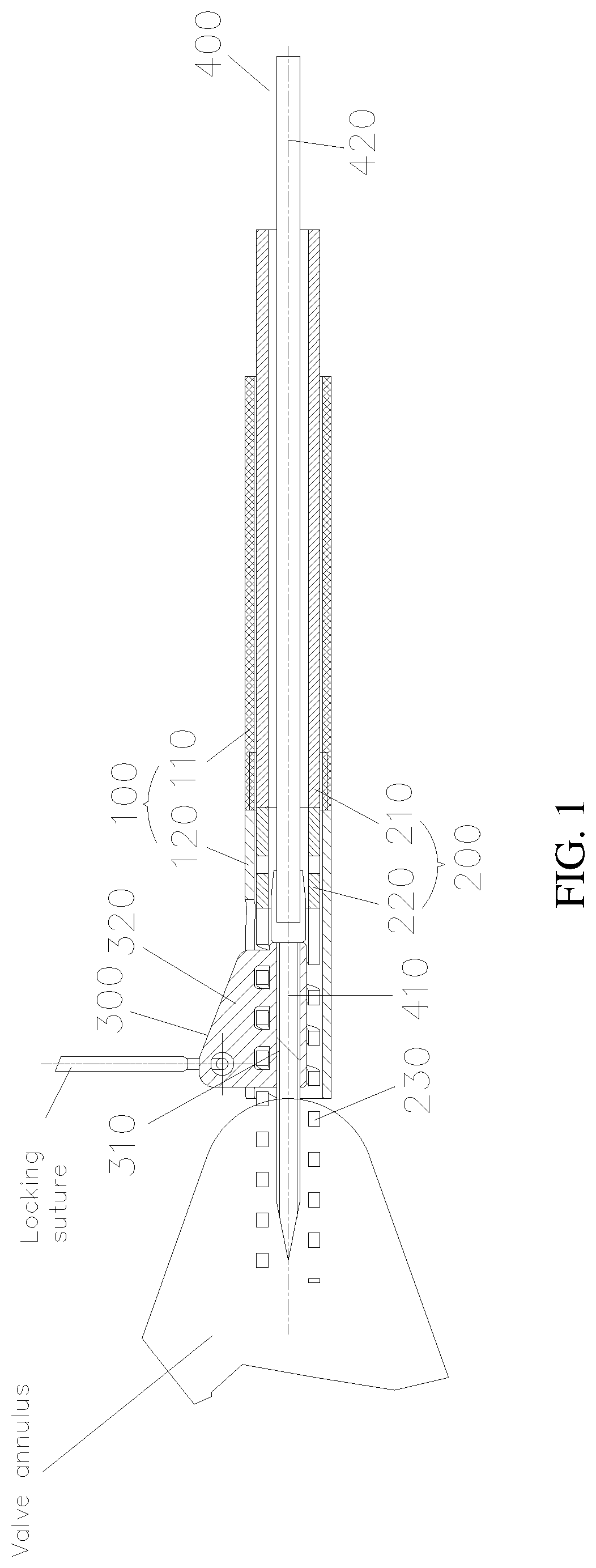 Patent US12090054 — Anchor delivery device for repairing heart valve — Figure 1