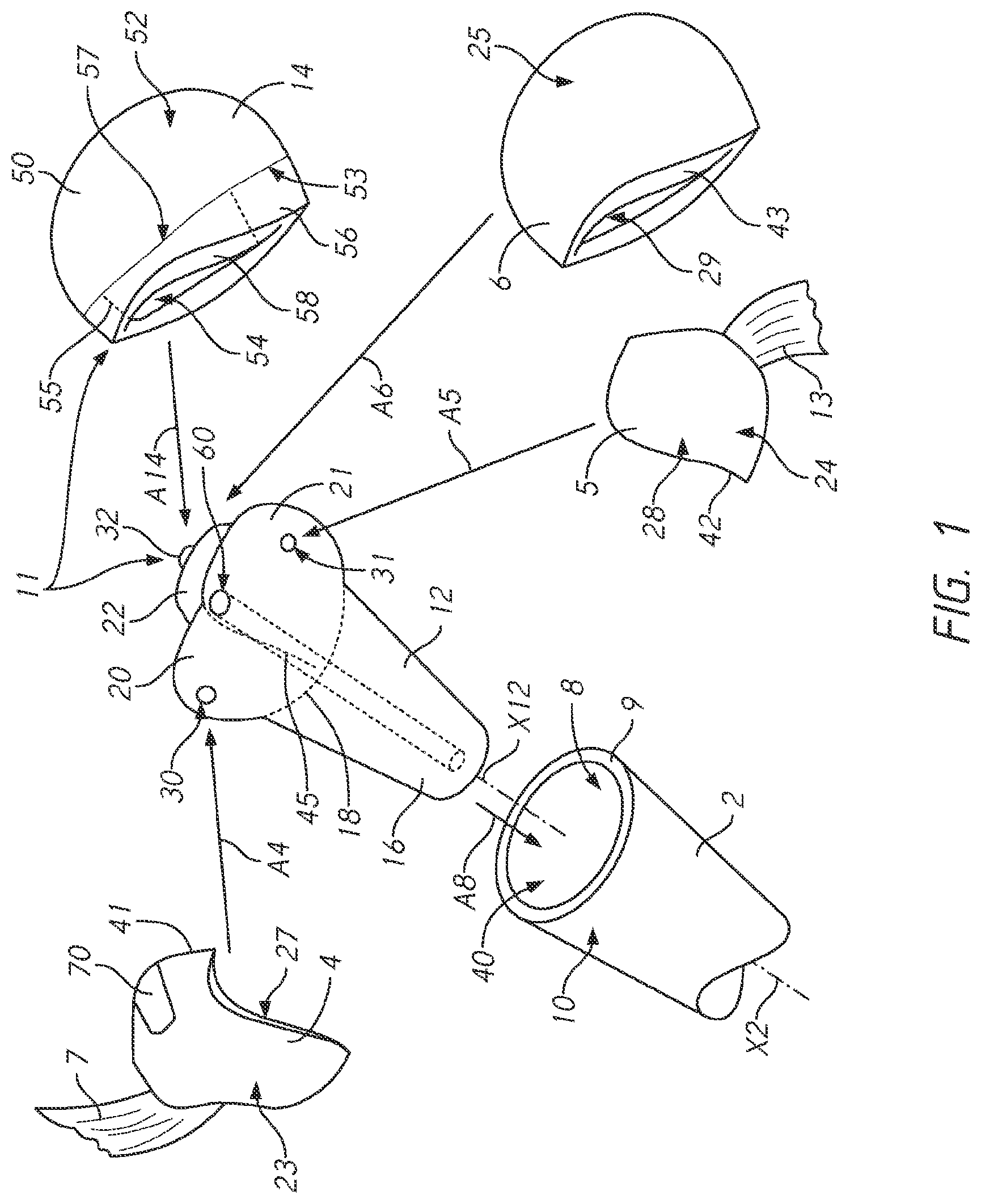 Patent US12090057 — Patient-specific bone fracture prostheses and methods of making the same — Figure 1