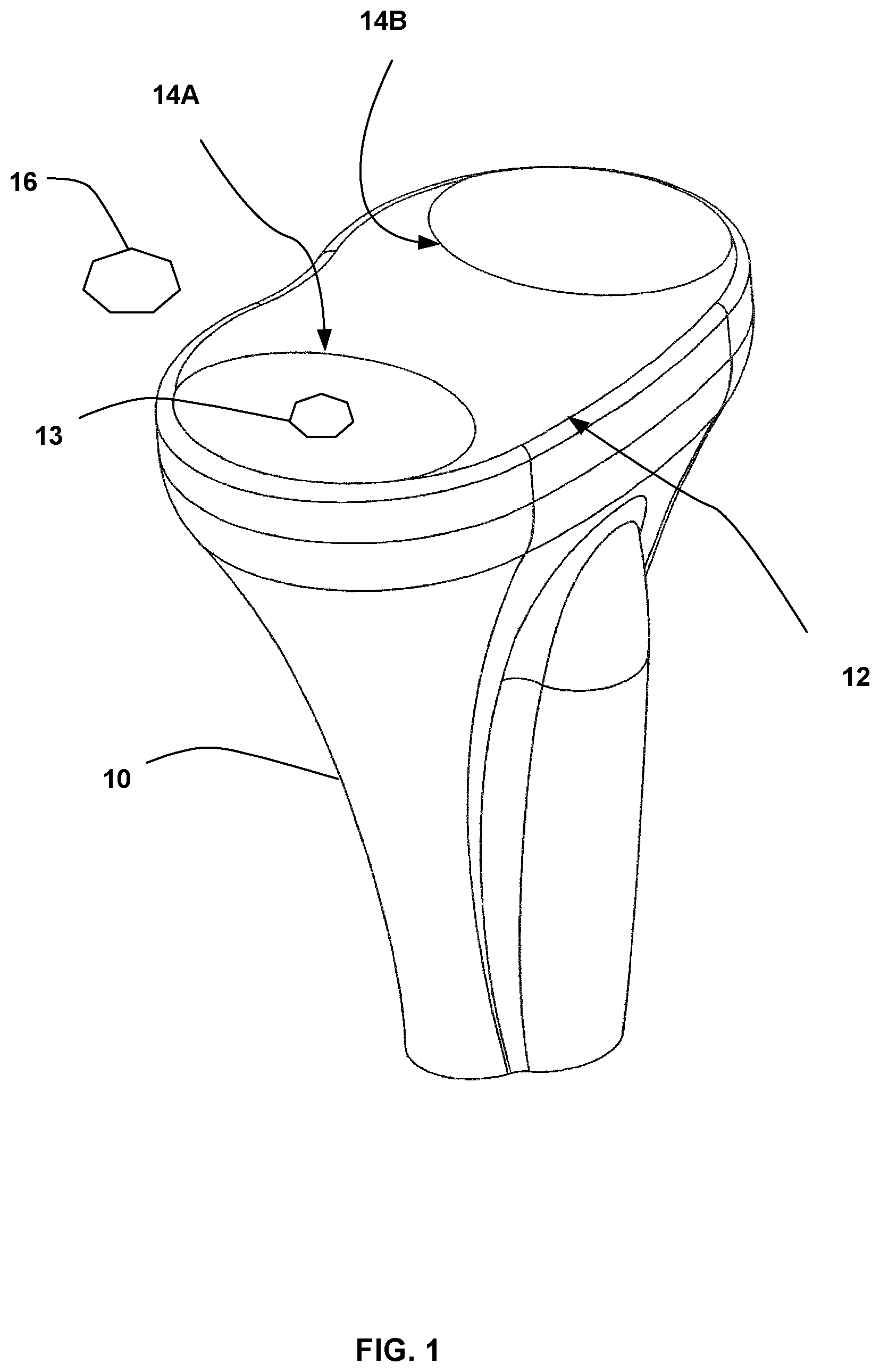 Patent US12090058 Figure 1 – Tibial resurfacing system and method
