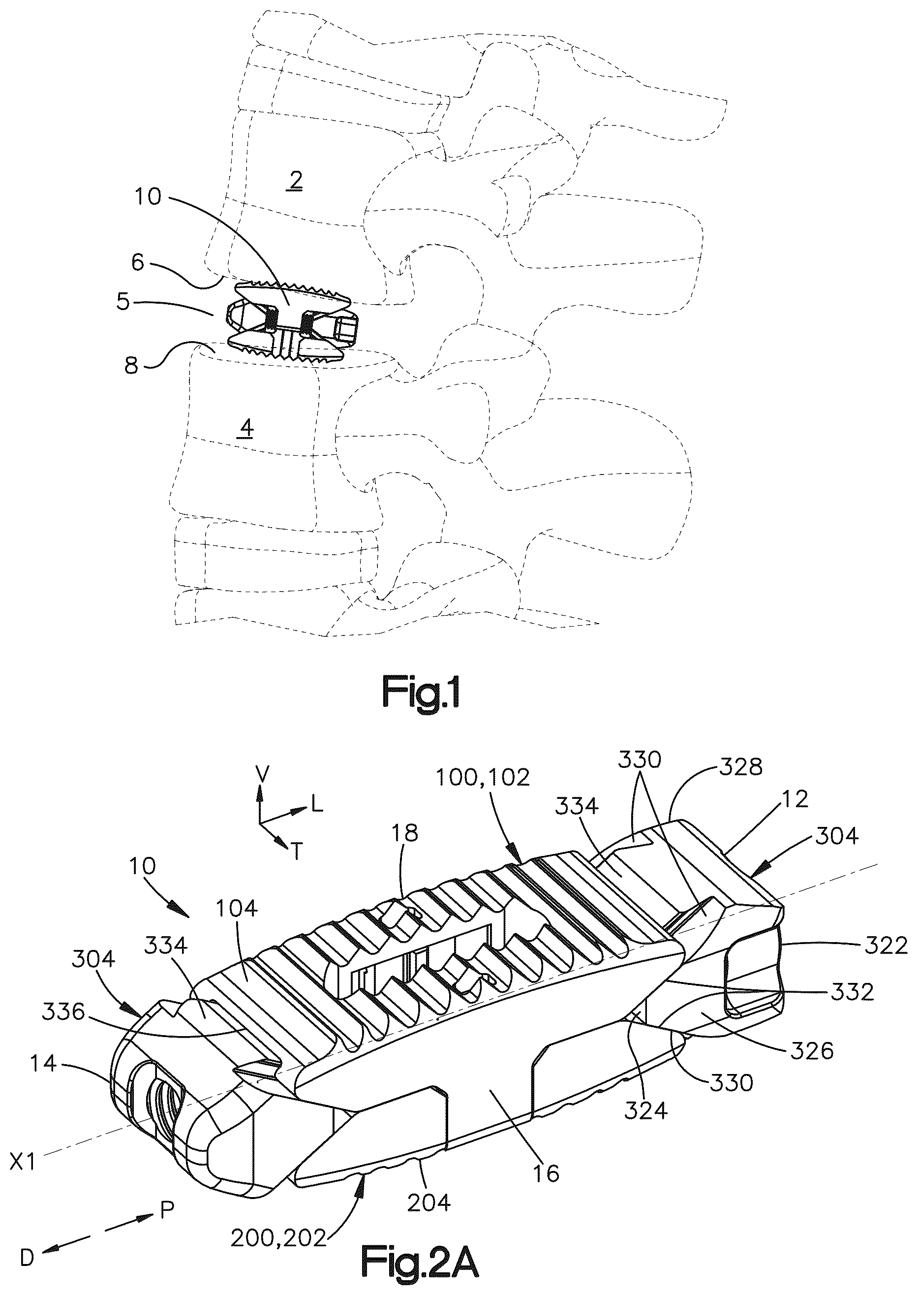 Patent US12090064 — Stabilization members for expandable intervertebral implants, and related systems and methods — Figure 1