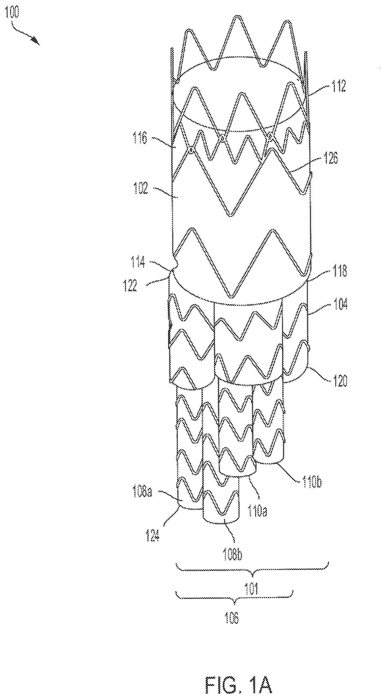Patent US12090070 — Re-location of main body bypass branch on multi-branched stent graft — Figure 1