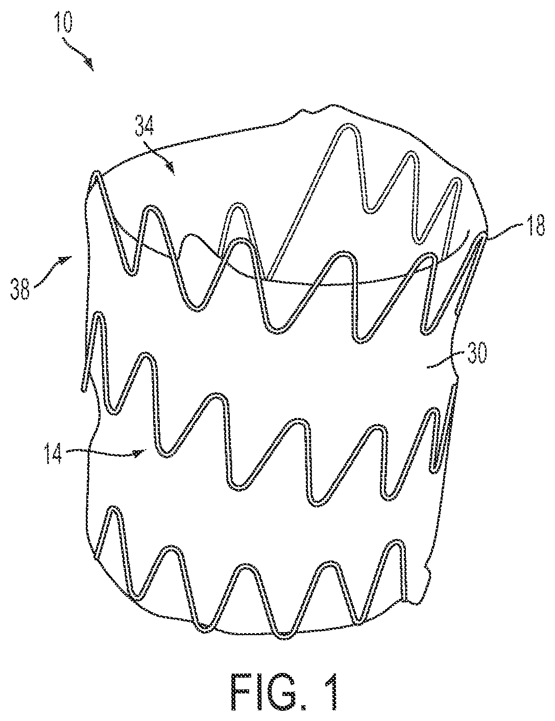 Patent US12090071 — Vascular prosthetic assemblies — Figure 1