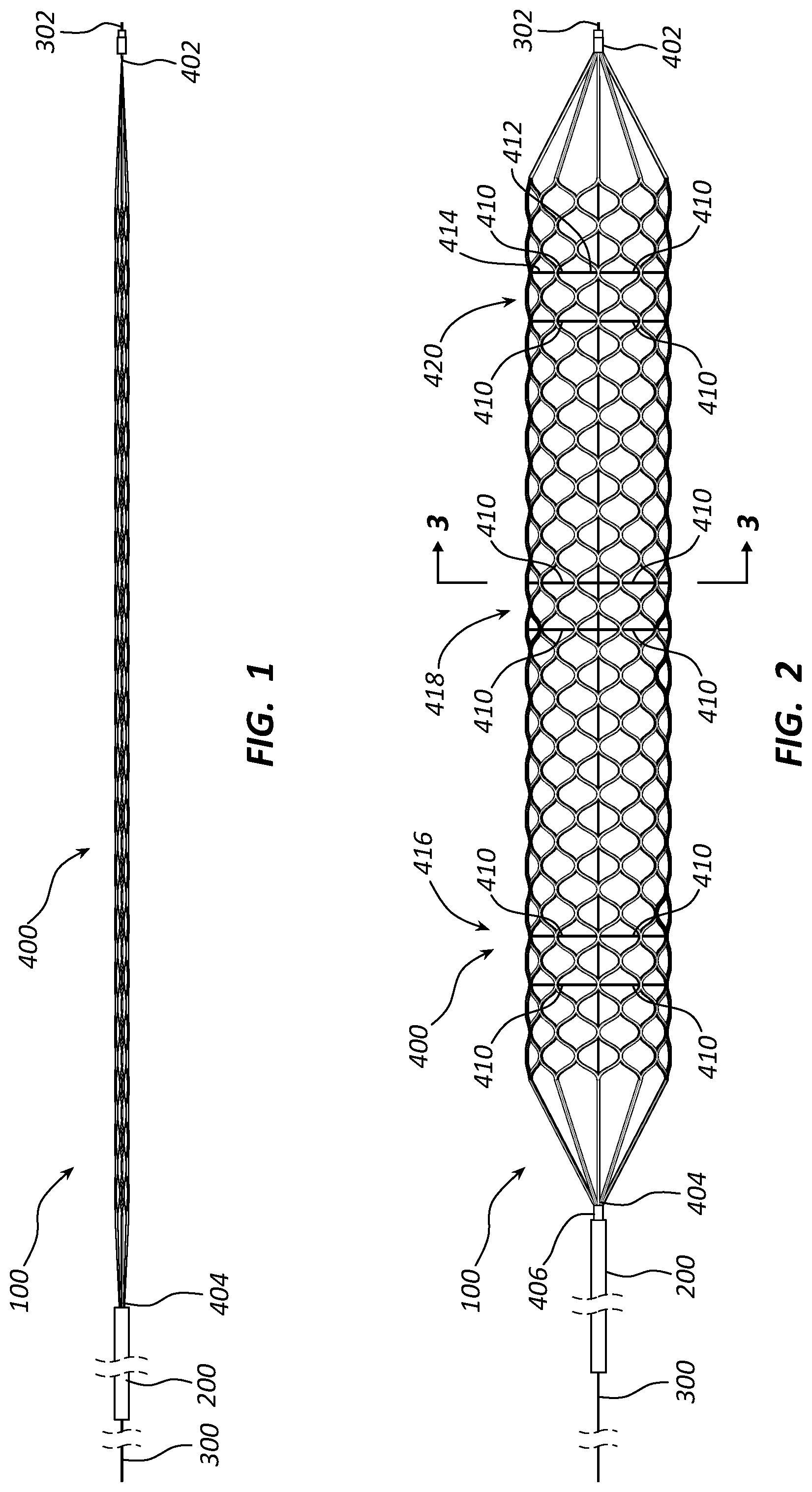 Patent US12090072 — Systems and methods for delivery retrievable stents — Figure 1