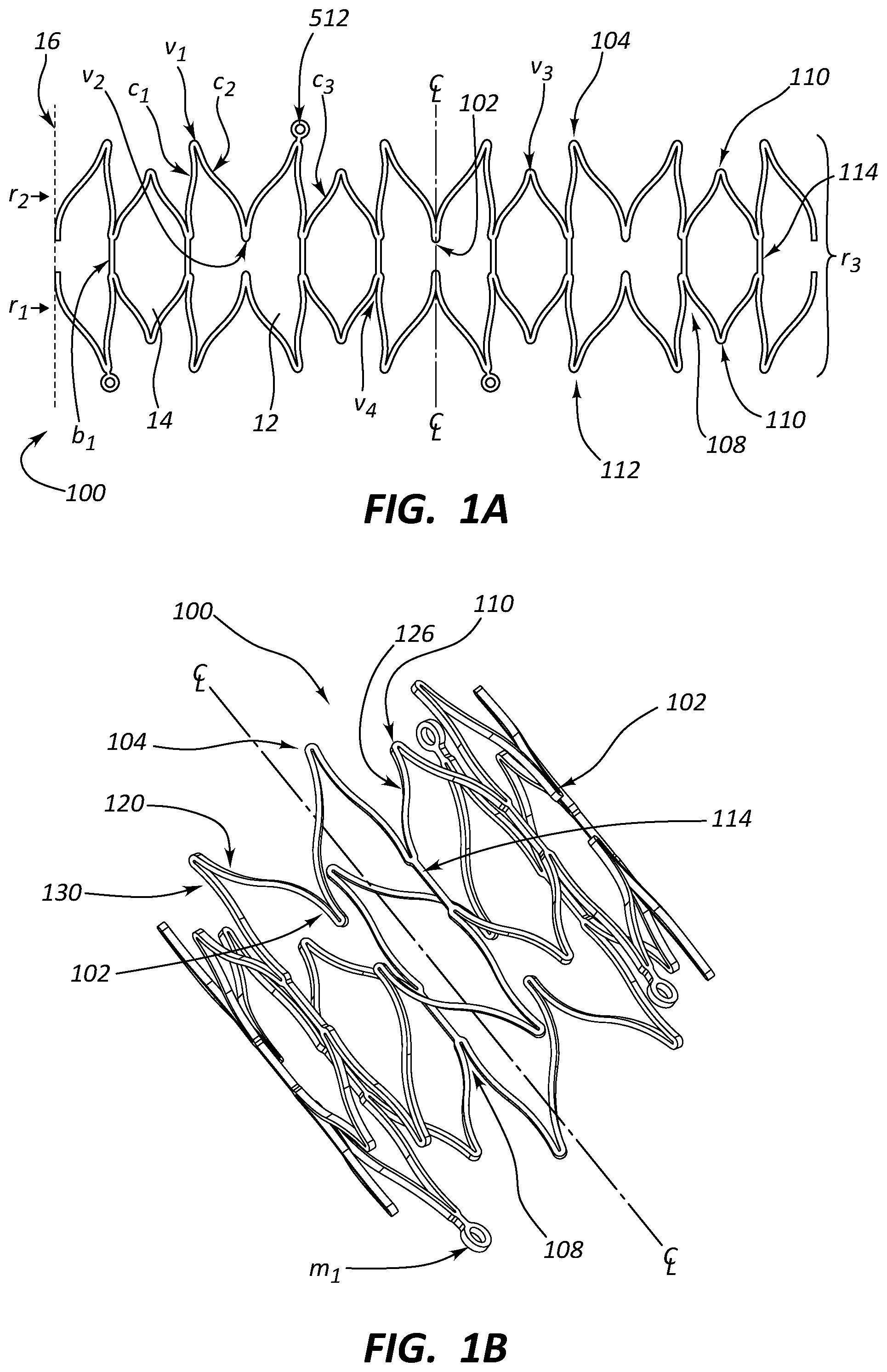 Patent US12090073 — Short stent — Figure 1