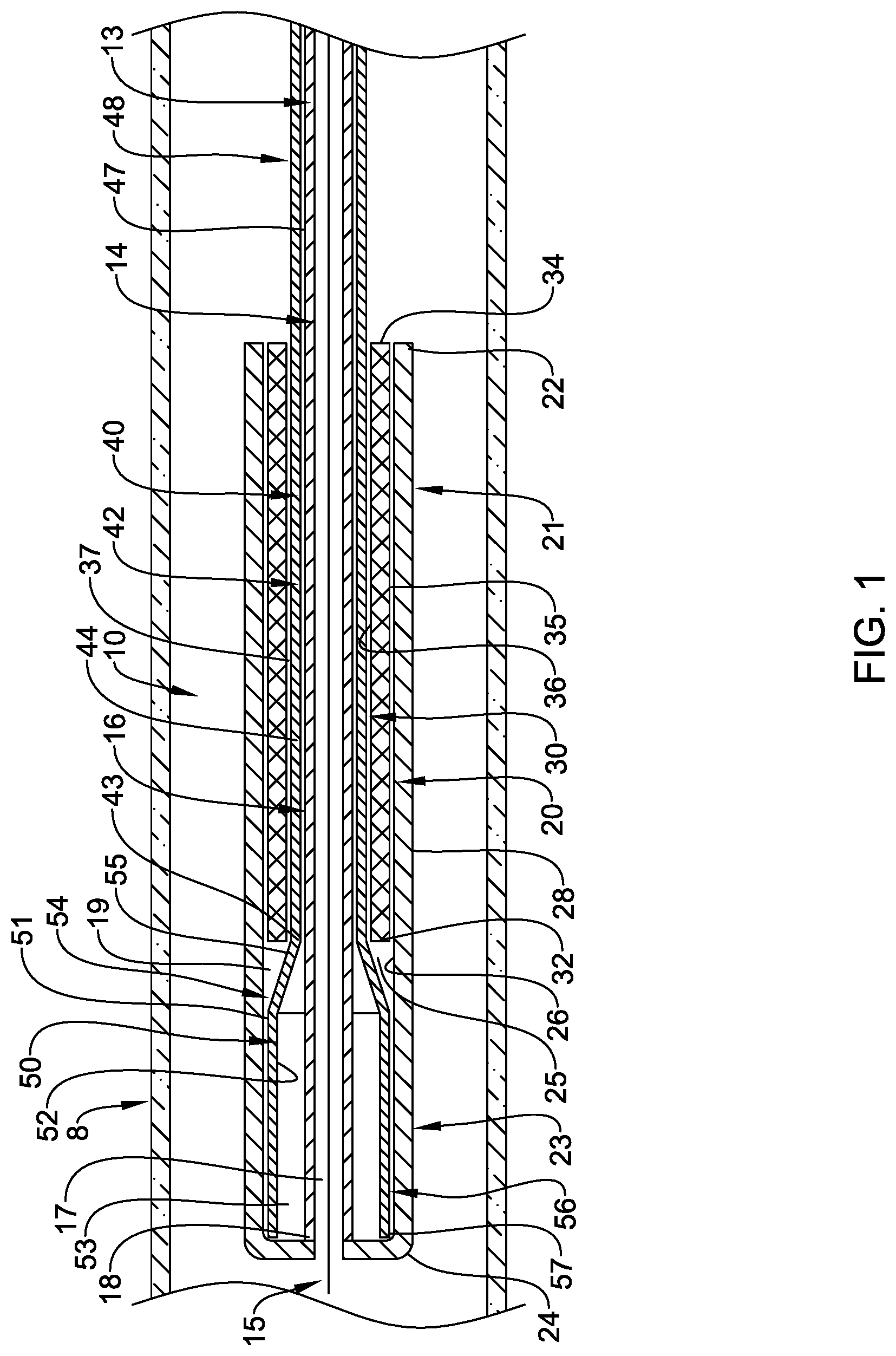Patent US12090074 — Stent delivery systems — Figure 1