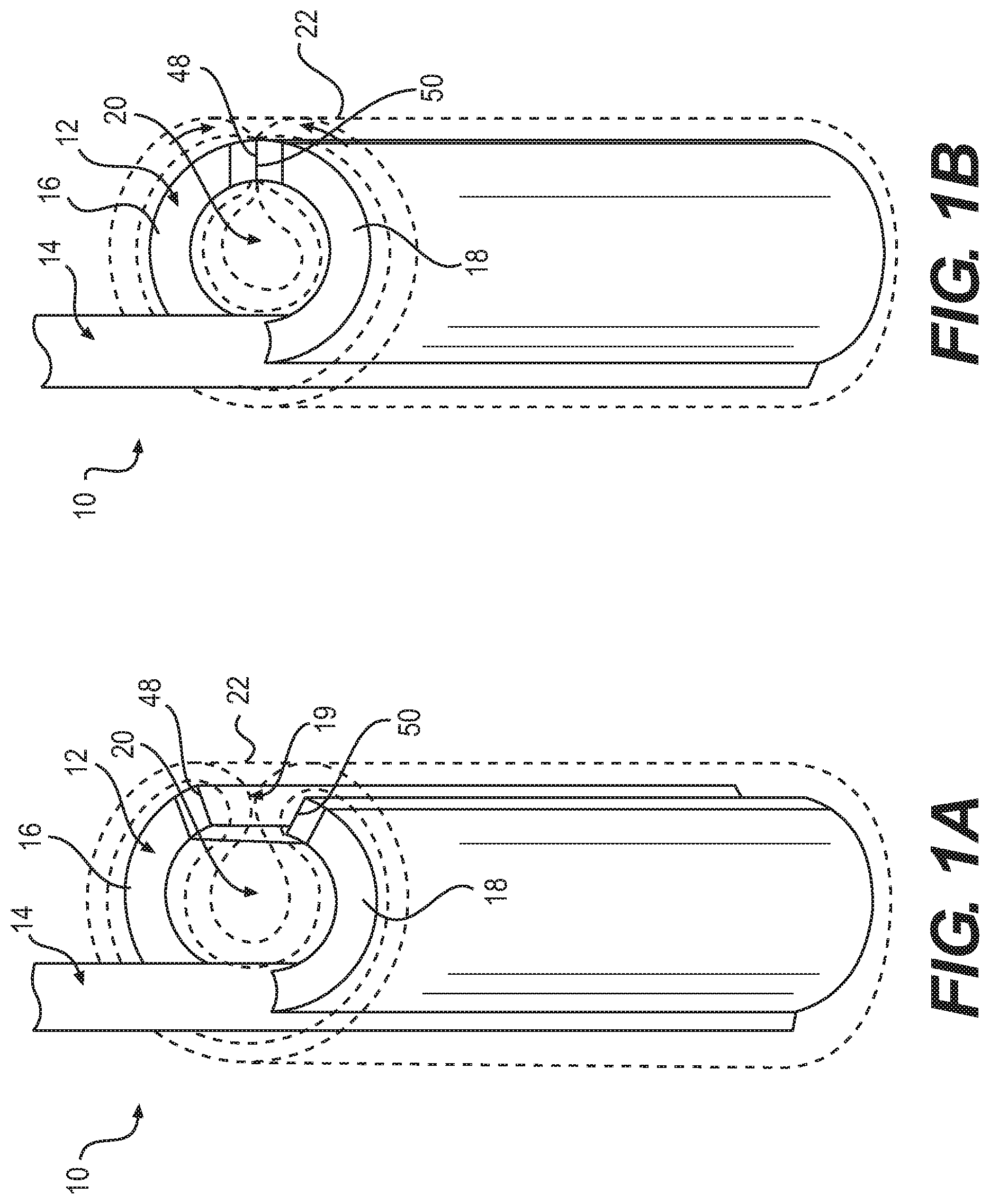 Patent US12090076 — Devices and related methods for gastrectomies — Figure 1