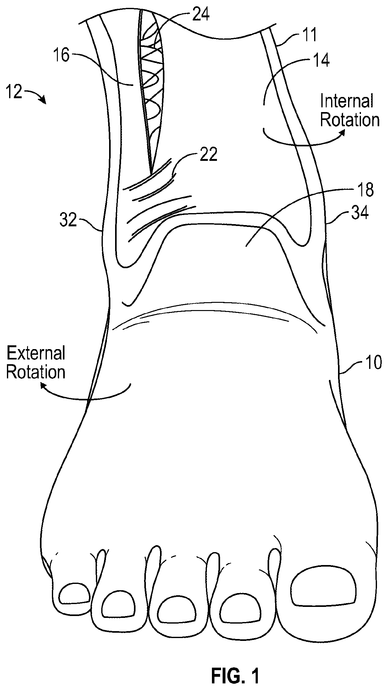 Patent US12090077 — Ankle brace — Figure 1