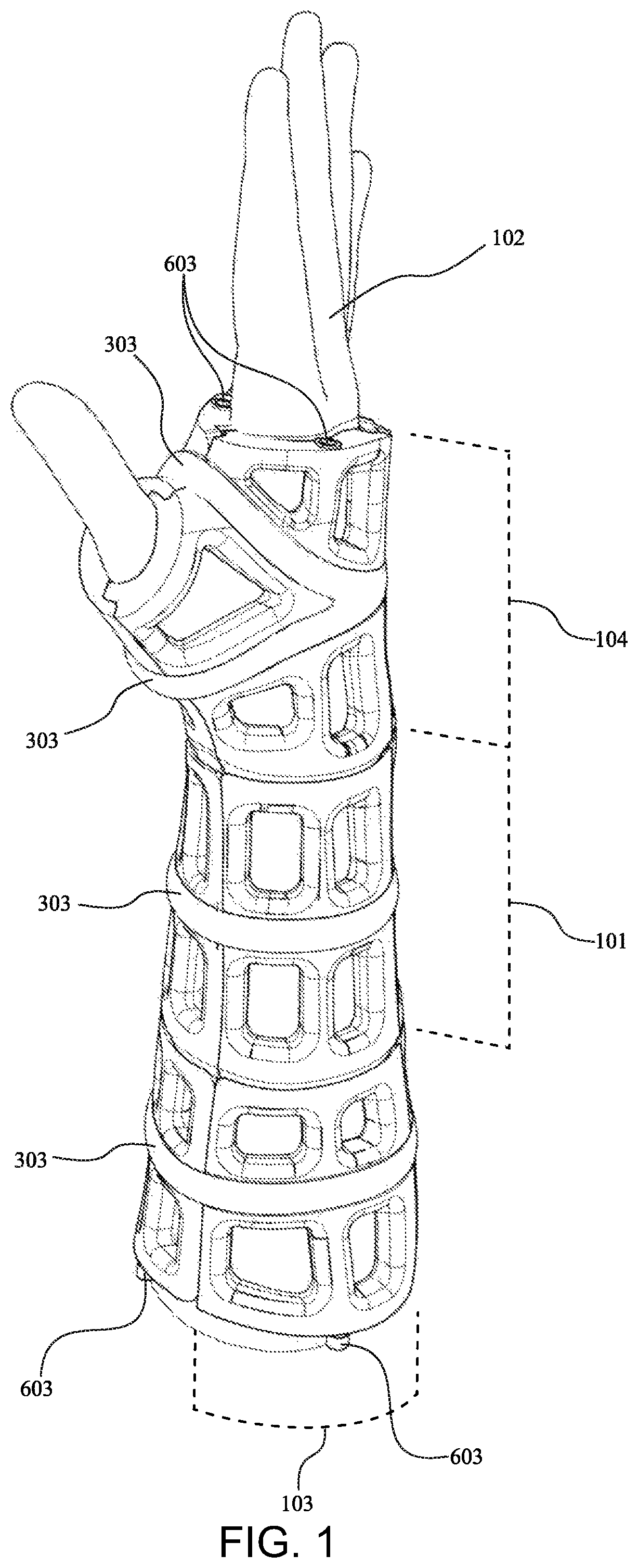 Patent US12090080 — Adaptive three-dimensional orthoses and methods for their manufacture and use — Figure 1