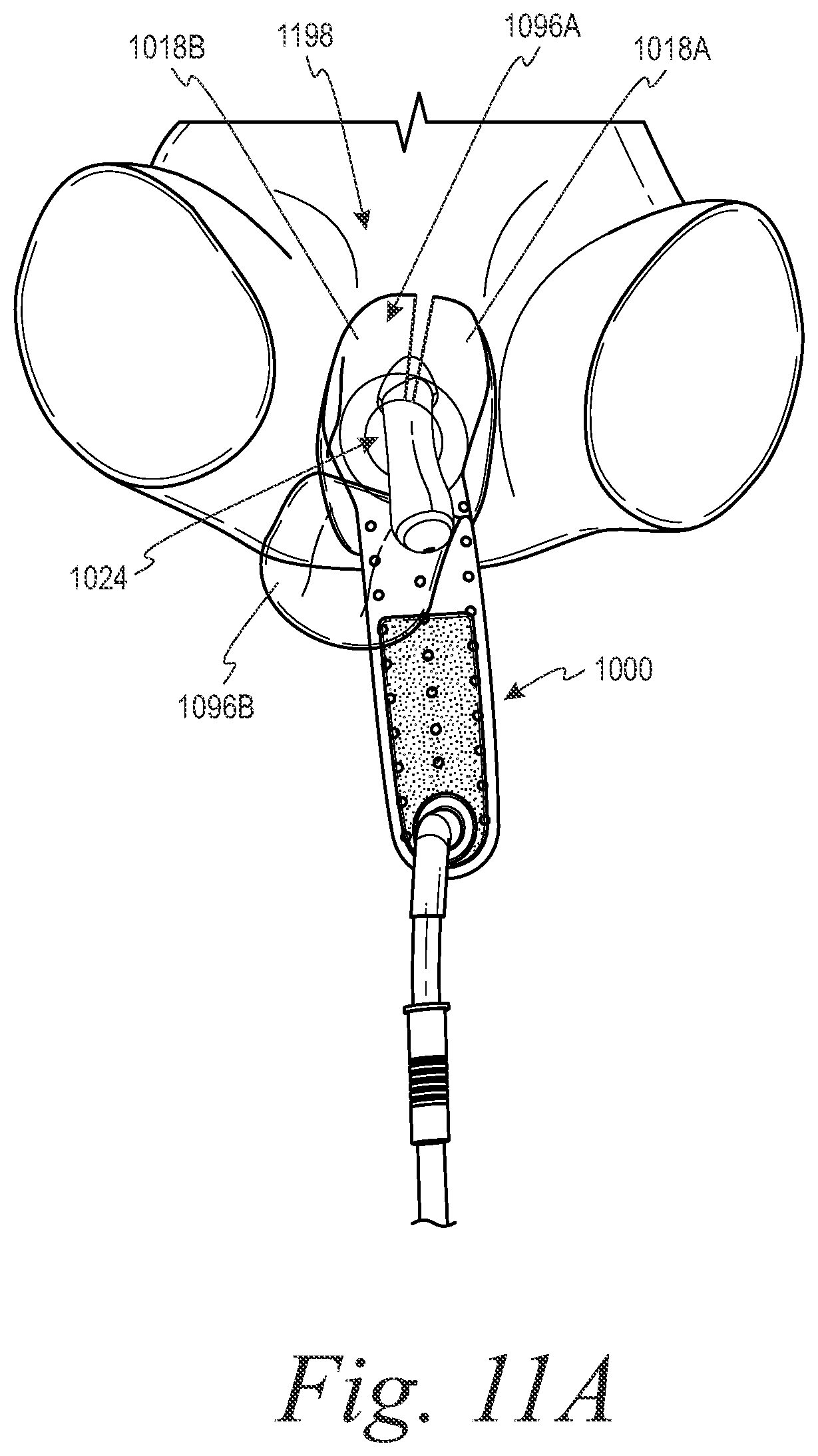 Patent US12090083 Figure 15 – Devices and systems for urine collection