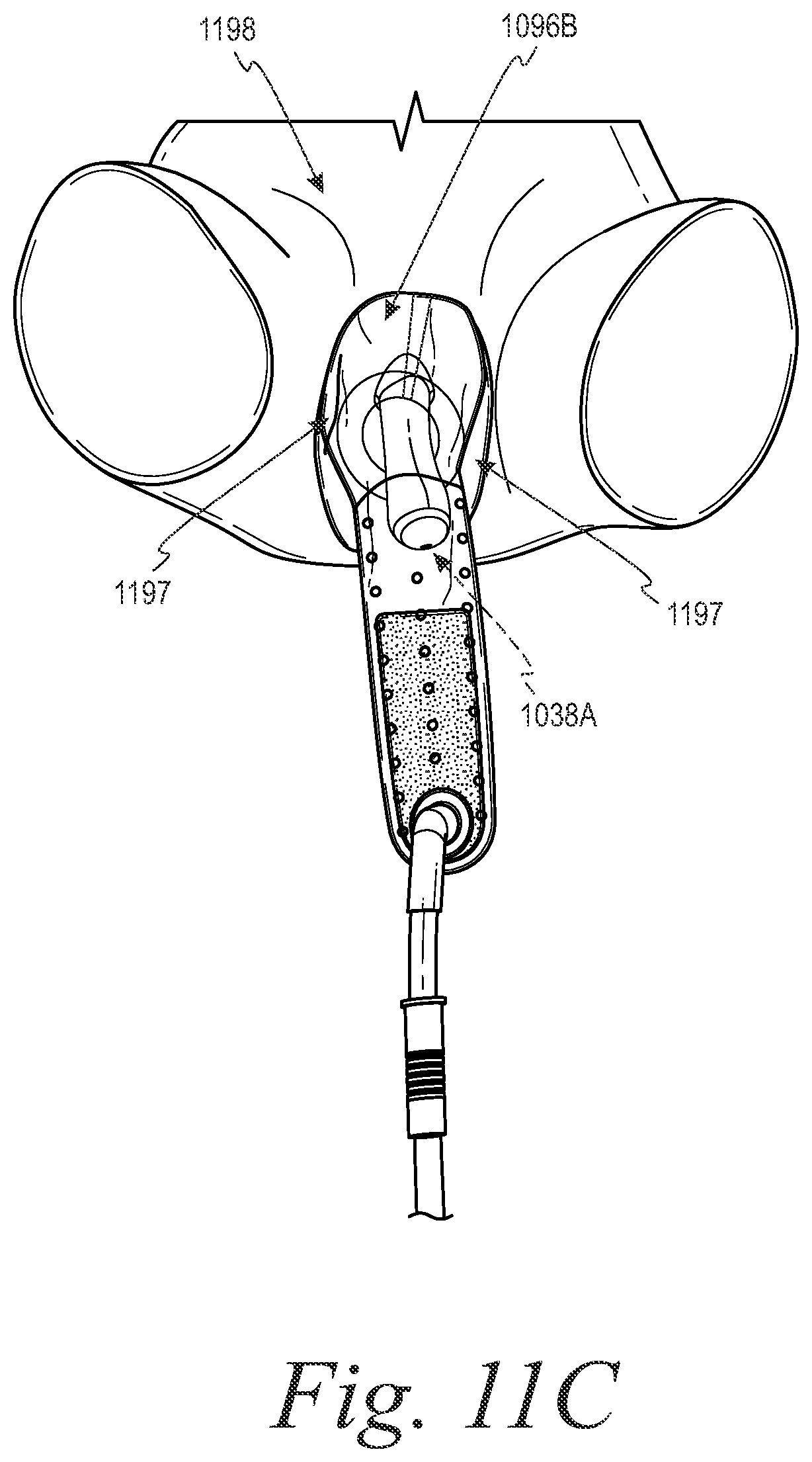 Patent US12090083 Figure 17 – Devices and systems for urine collection