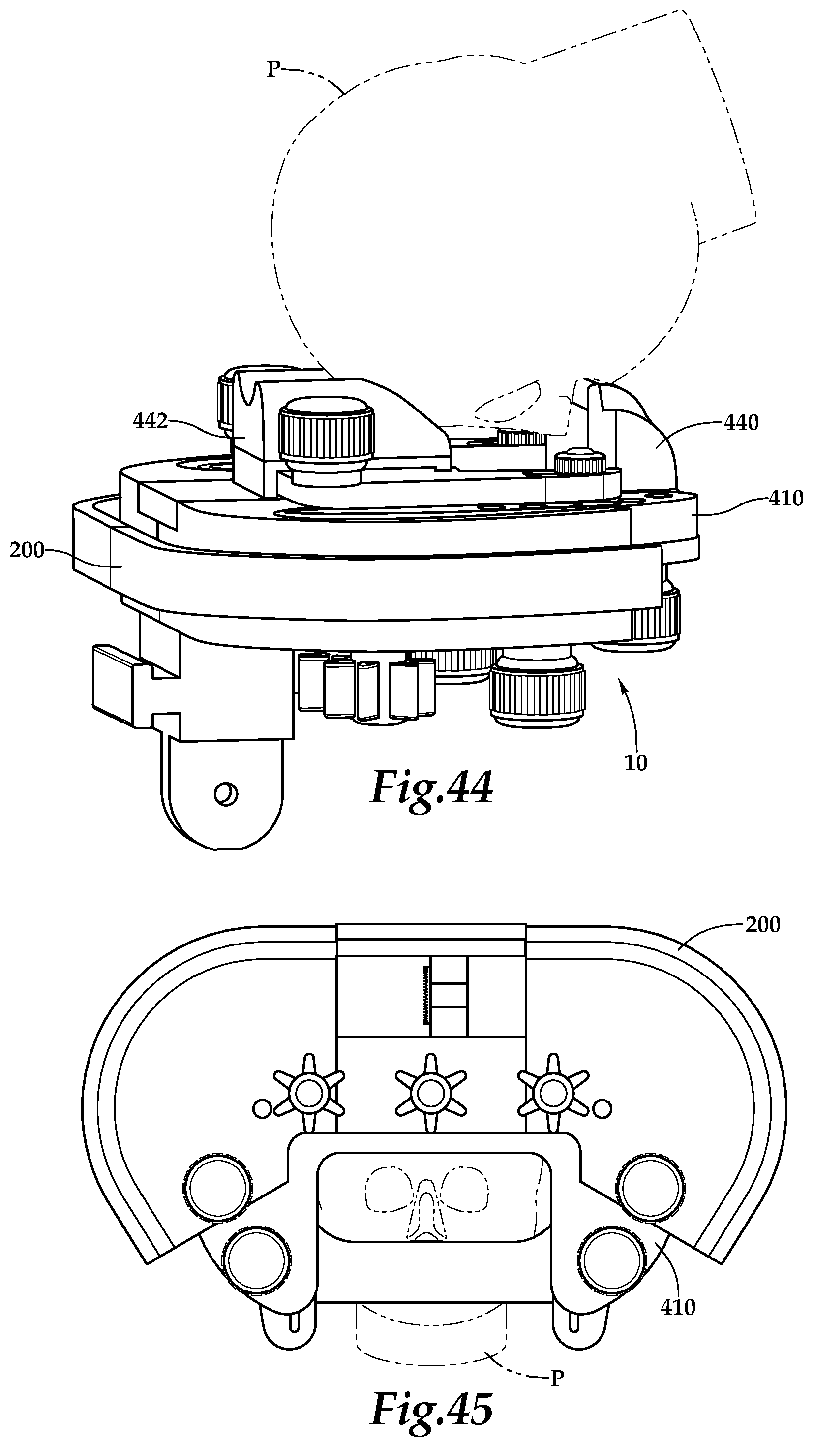 Patent US12090093 Figure 18 – Surgical universal headrest including skull pin holder assembly