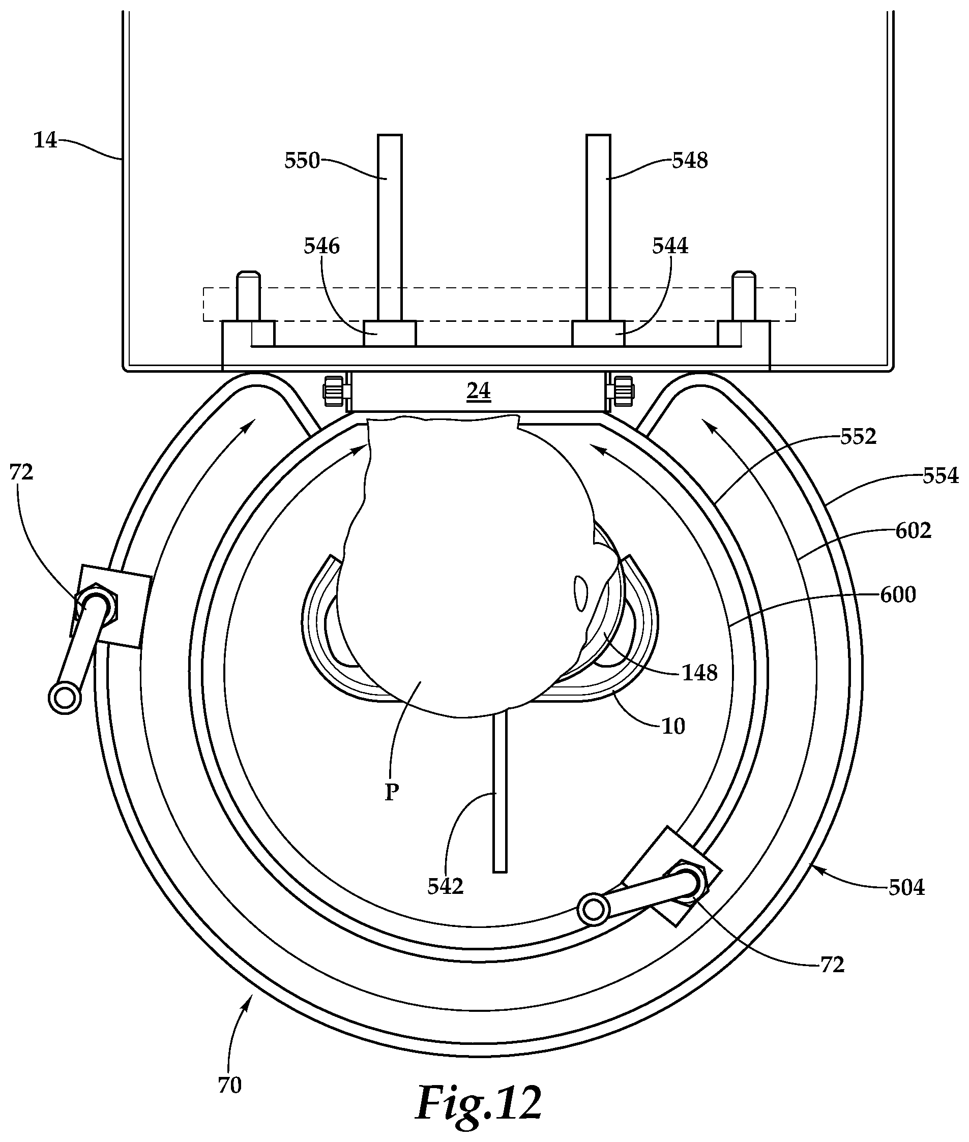 Patent US12090094 Figure 4 – Surgical universal headrest including skull pin holder assembly