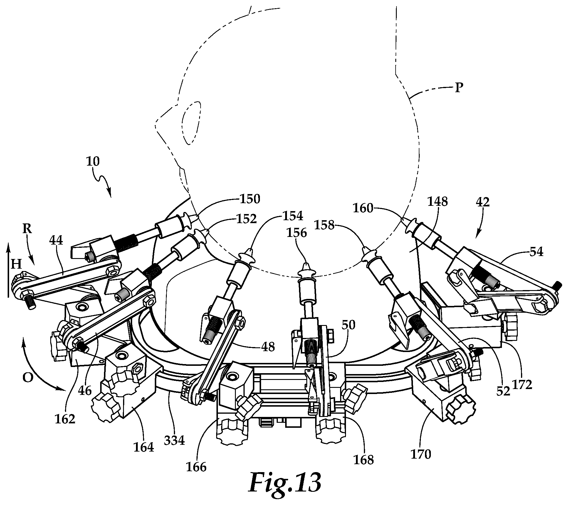 Patent US12090094 Figure 5 – Surgical universal headrest including skull pin holder assembly