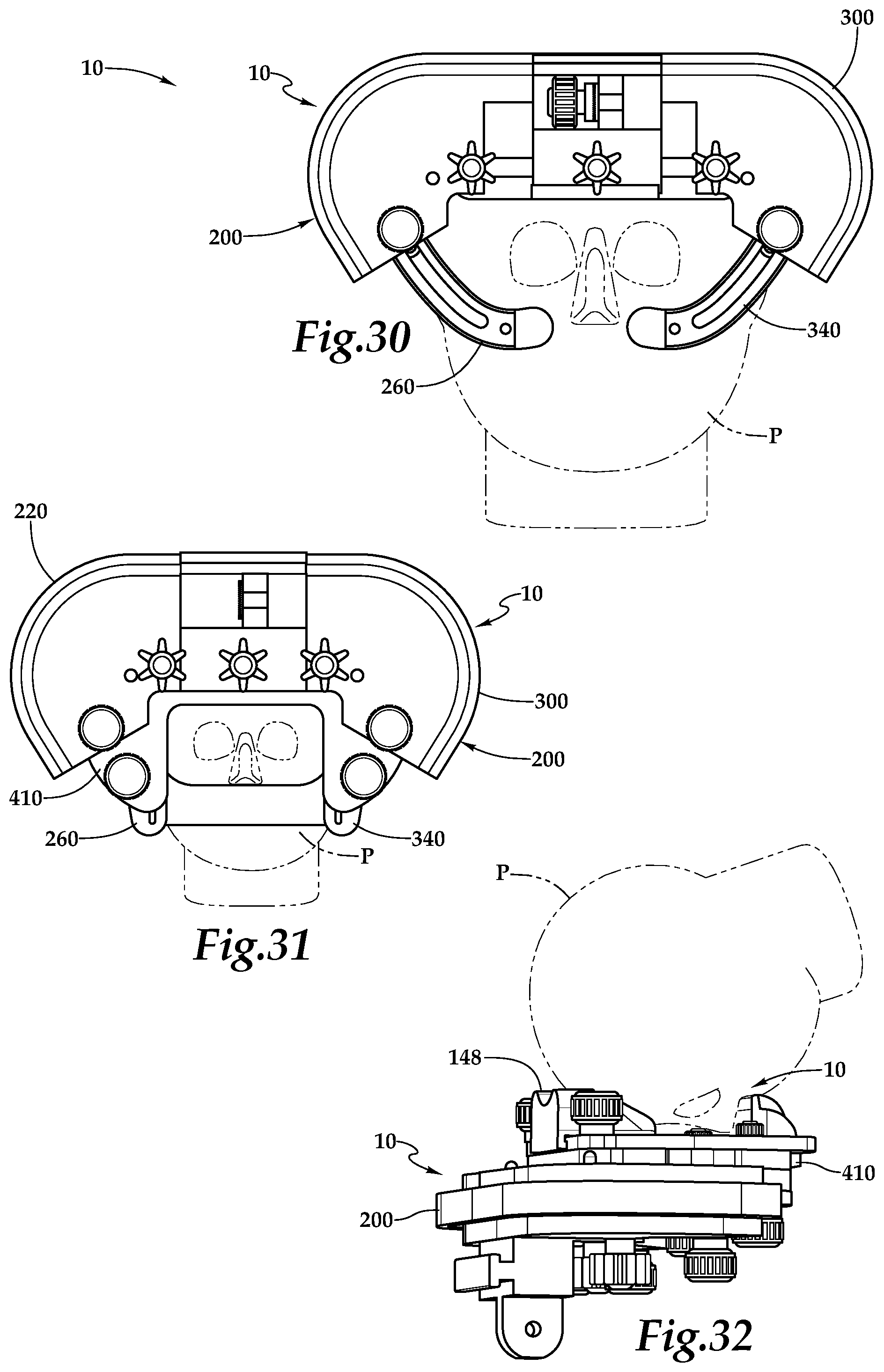 Patent US12090094 Figure 12 – Surgical universal headrest including skull pin holder assembly