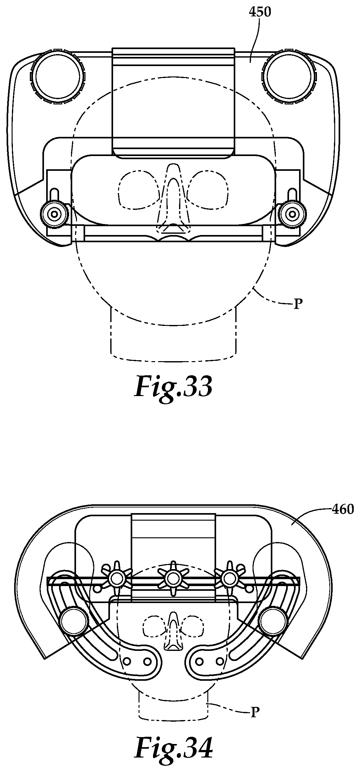 Patent US12090094 Figure 13 – Surgical universal headrest including skull pin holder assembly