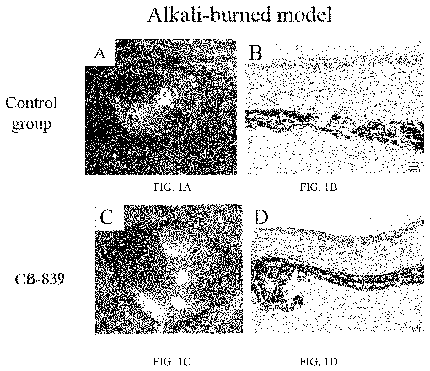 Patent US12090156 Figure 1 – Application of CB-839 in preparation of drug for inhibiting corneal neovascularization (CNV)