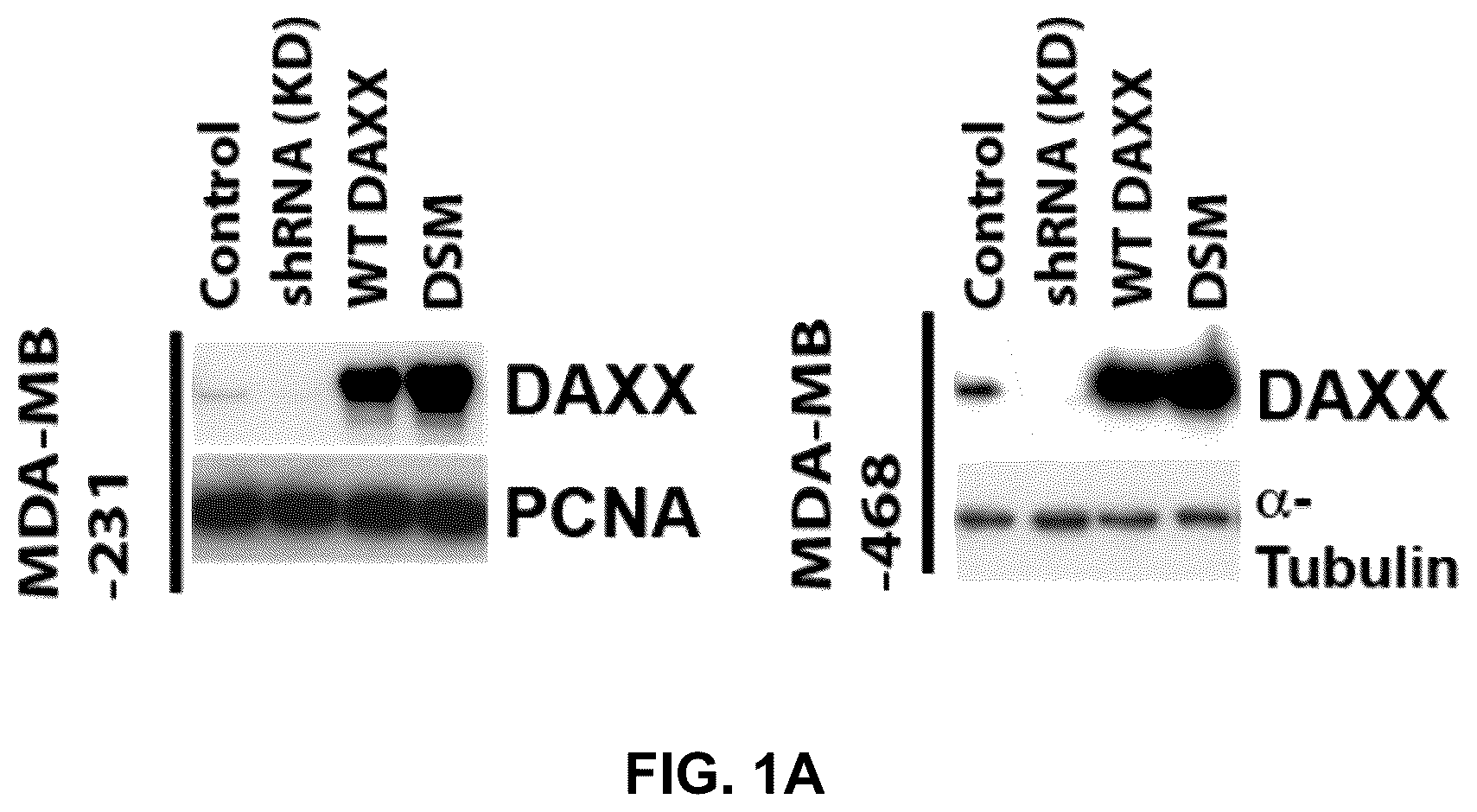 Patent US12090189 — Polypeptide inhibitor of de novo lipogenesis in cancer cells — Figure 1