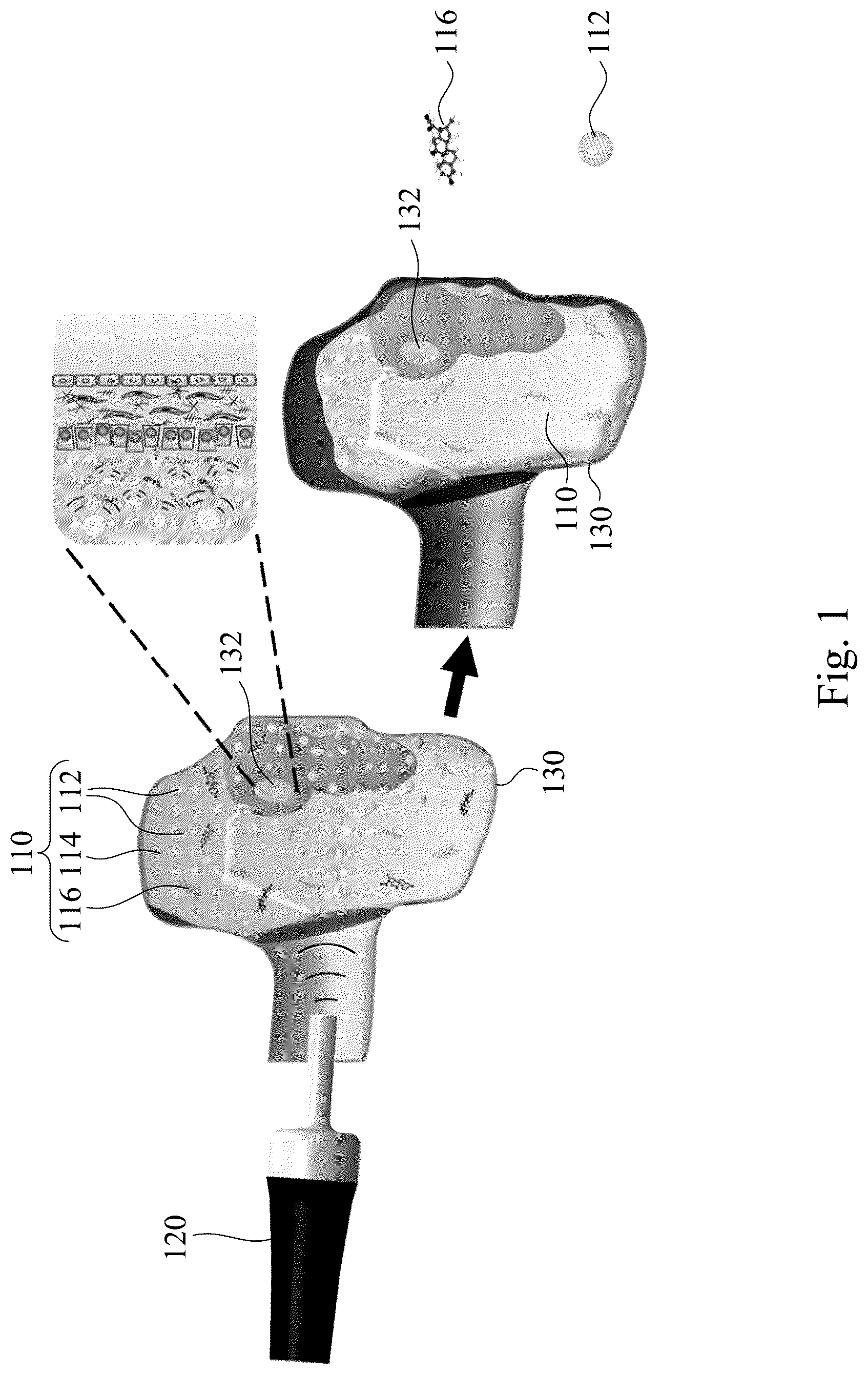 Patent US12090207 Figure 1 – Drug delivery composition, method forming the same and method for treating inner ear disorders