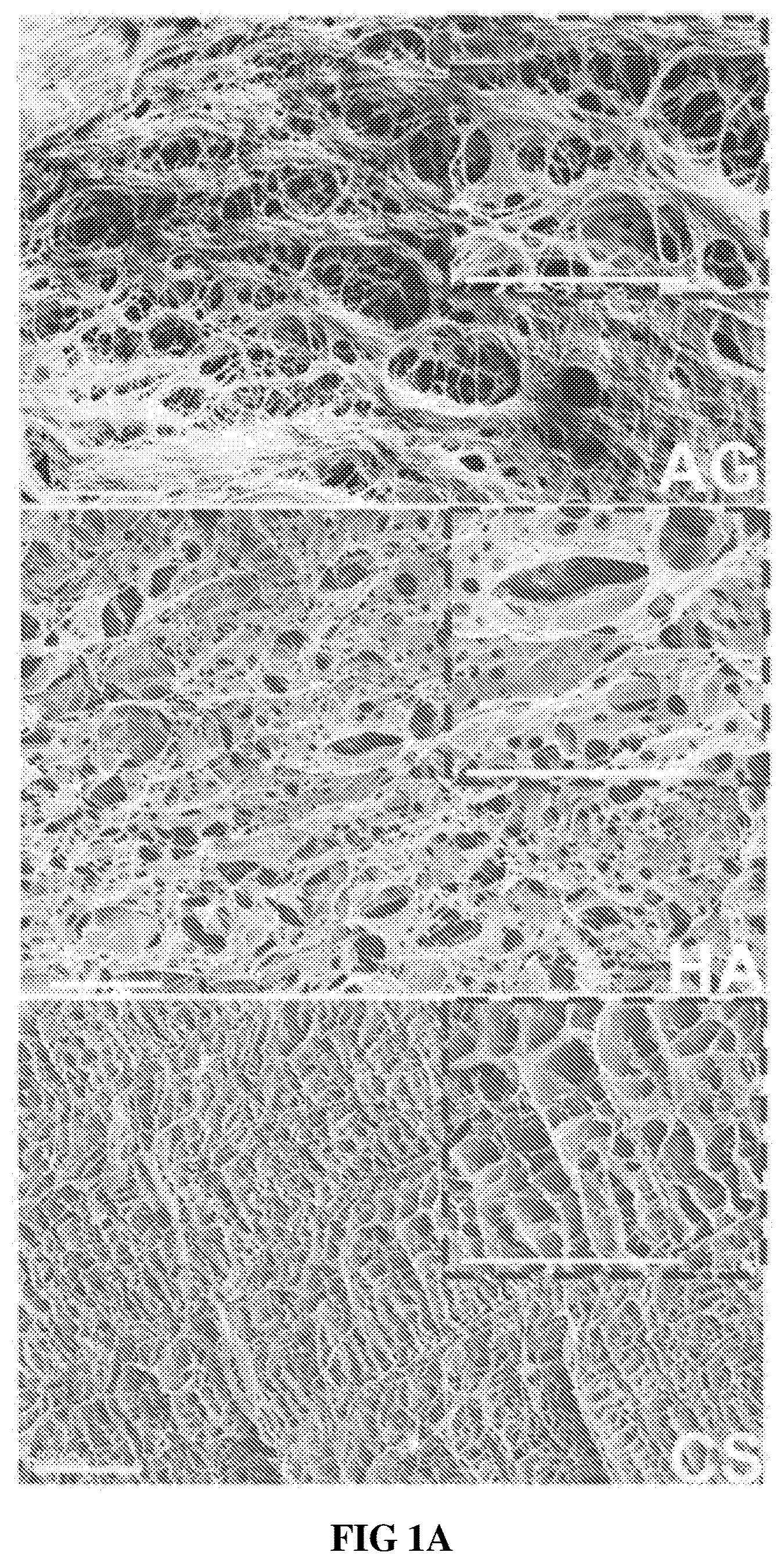 Patent US12090229 — Chondroitin sulfate glycosaminoglycan hydrogel matrices for the treatment of traumatic brain injury — Figure 1