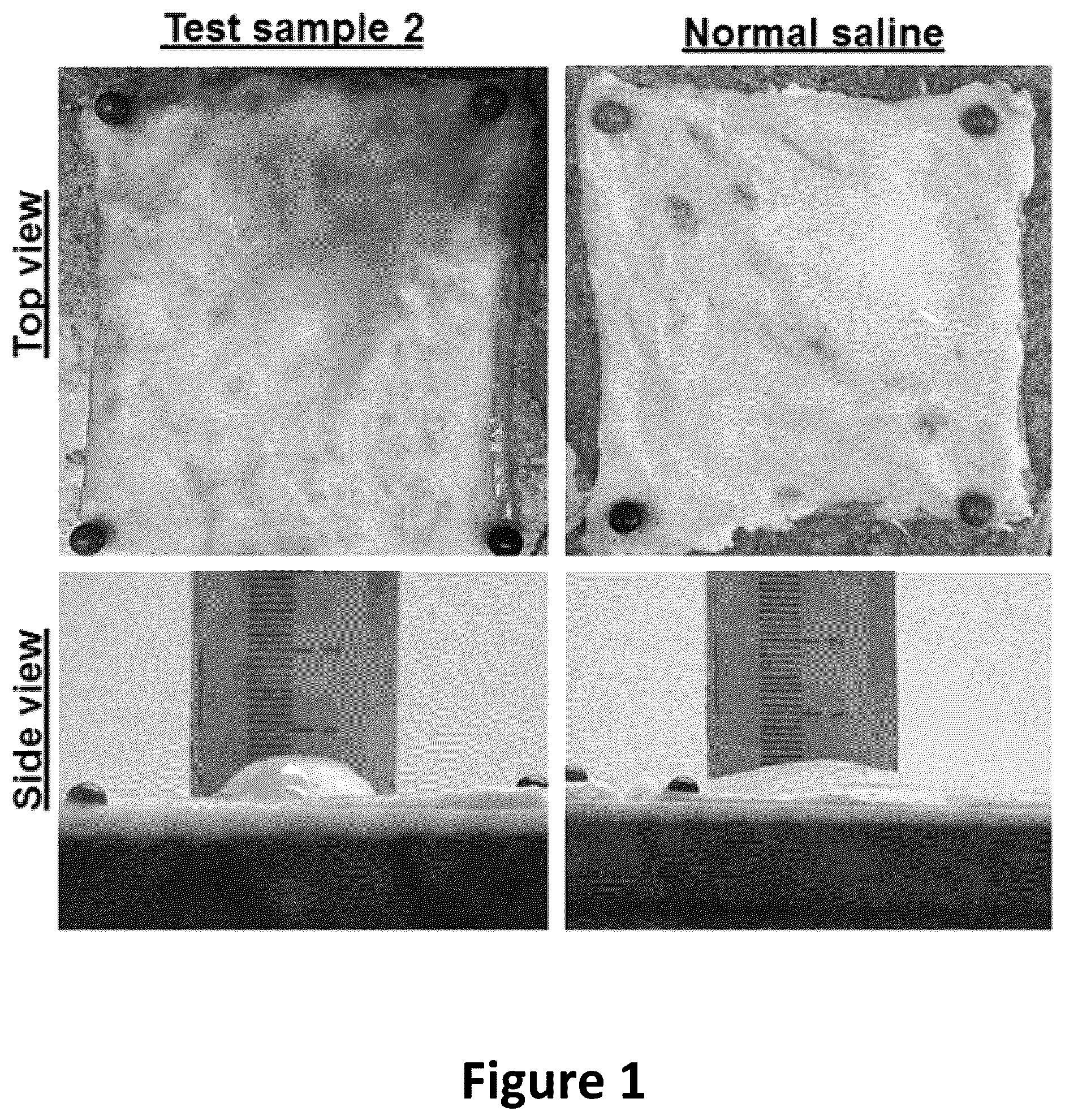 Patent US12090243 Figure 1 – Compositions comprising fluid gels for tissue separation