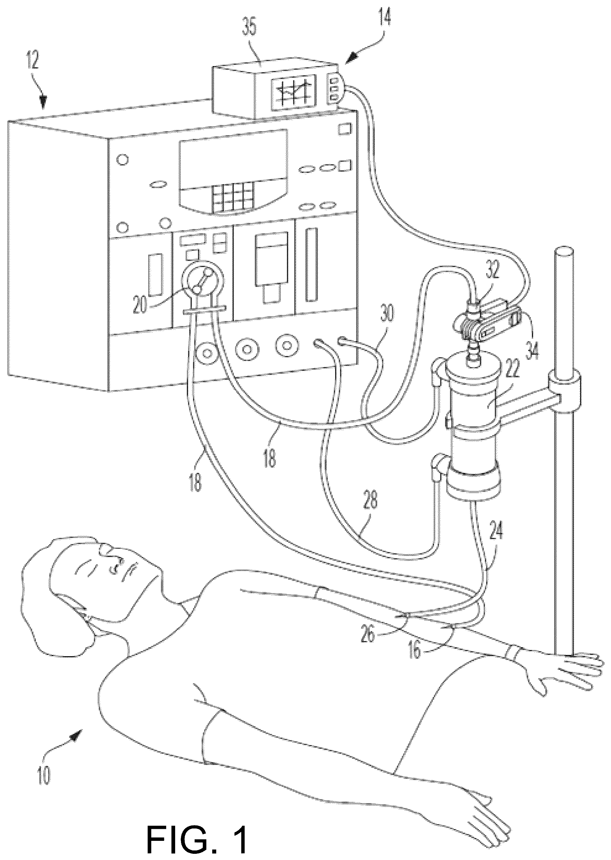 Patent US12090257 Figure 1 – Blood monitoring system for detecting occult hemorrhages