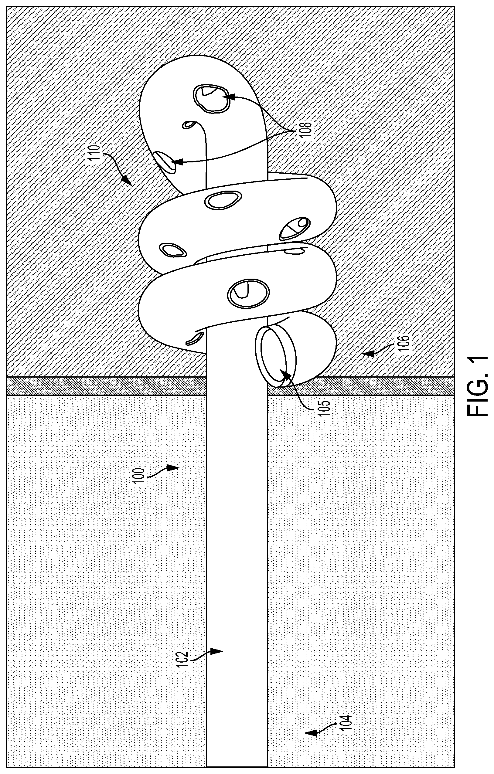 Patent US12090260 — Drainage or infusion catheter and method of use — Figure 1