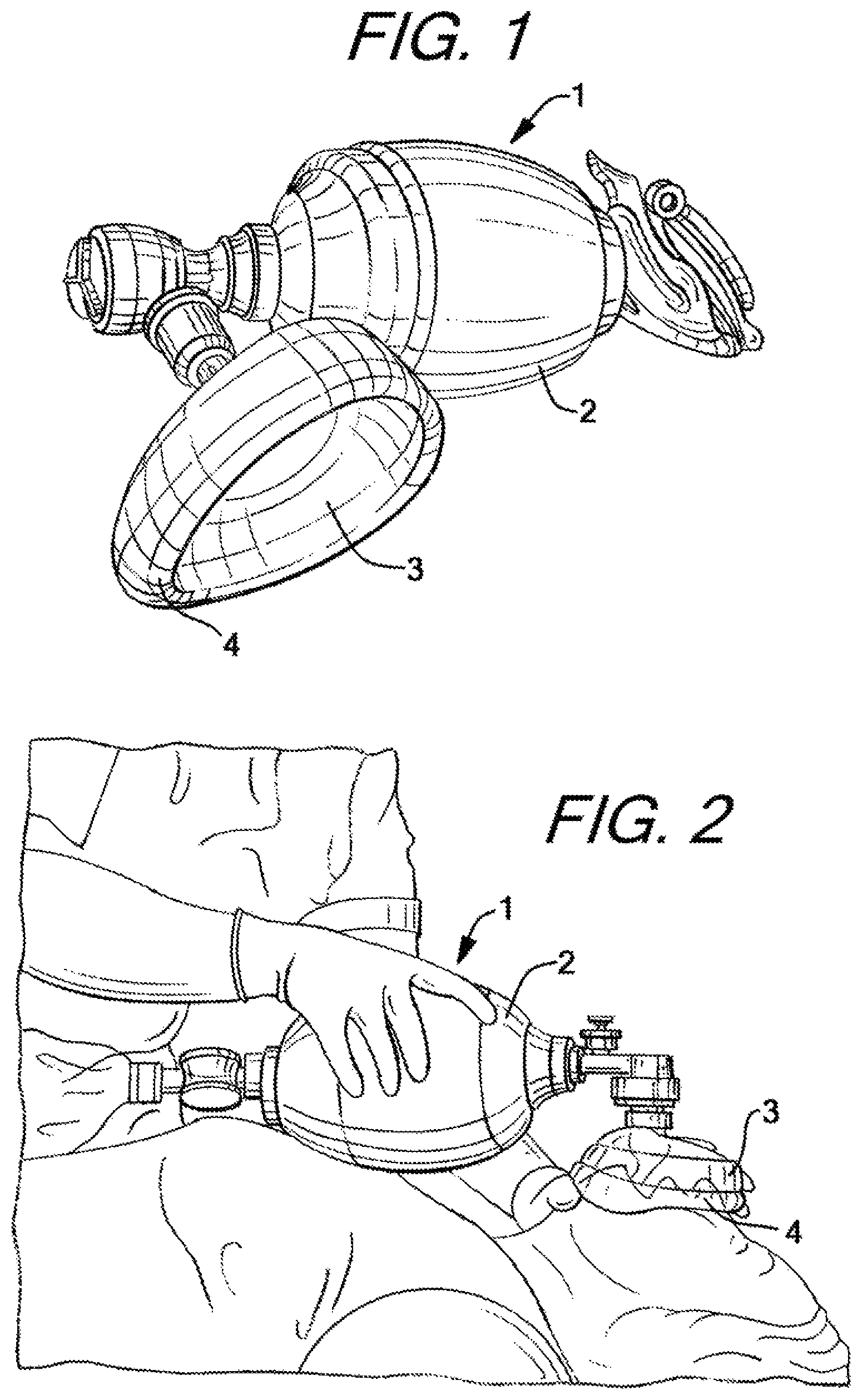 Patent US12090274 — Nasal ventilation mask — Figure 1