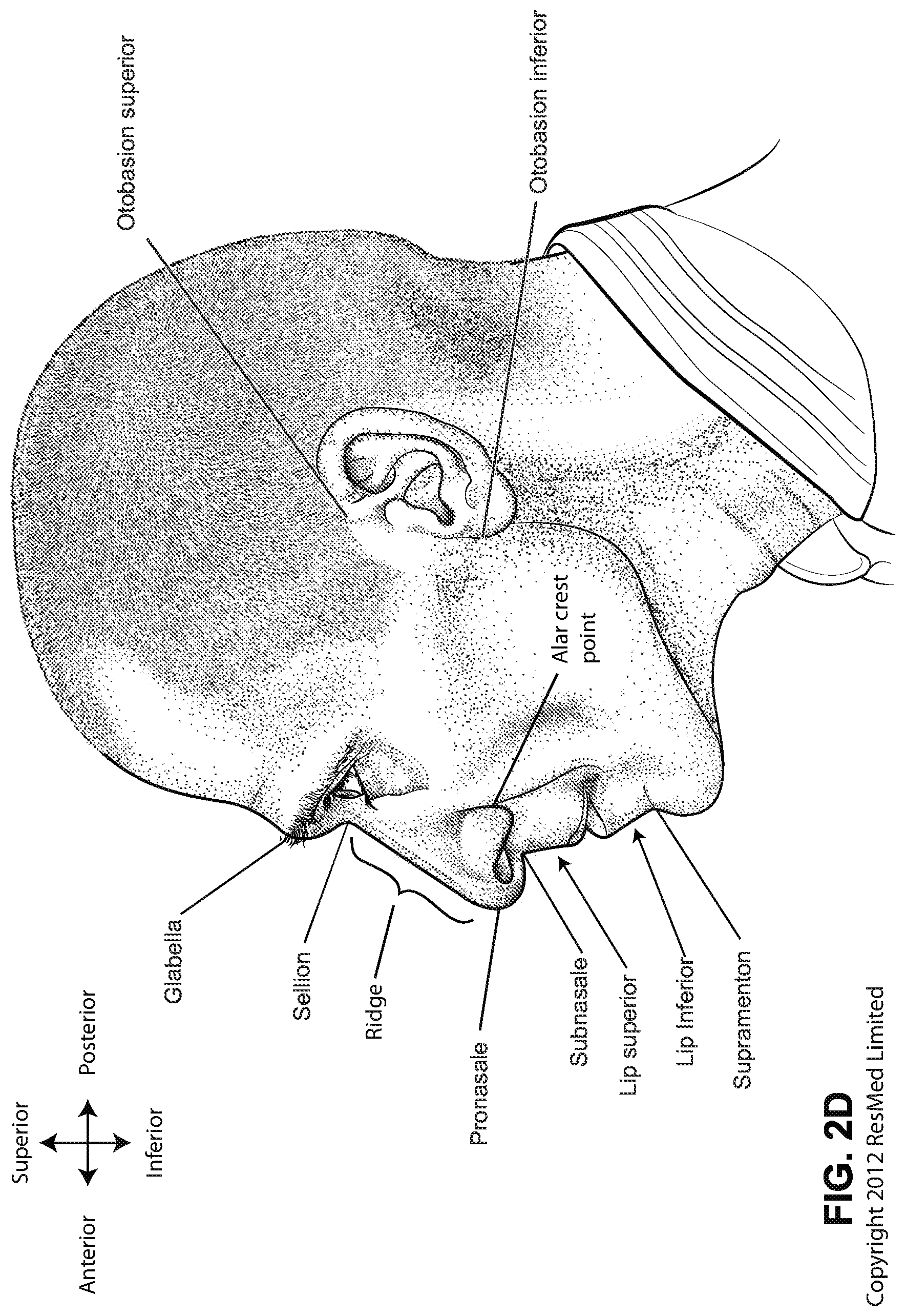 Patent US12090275 Figure 7 – Patient interface