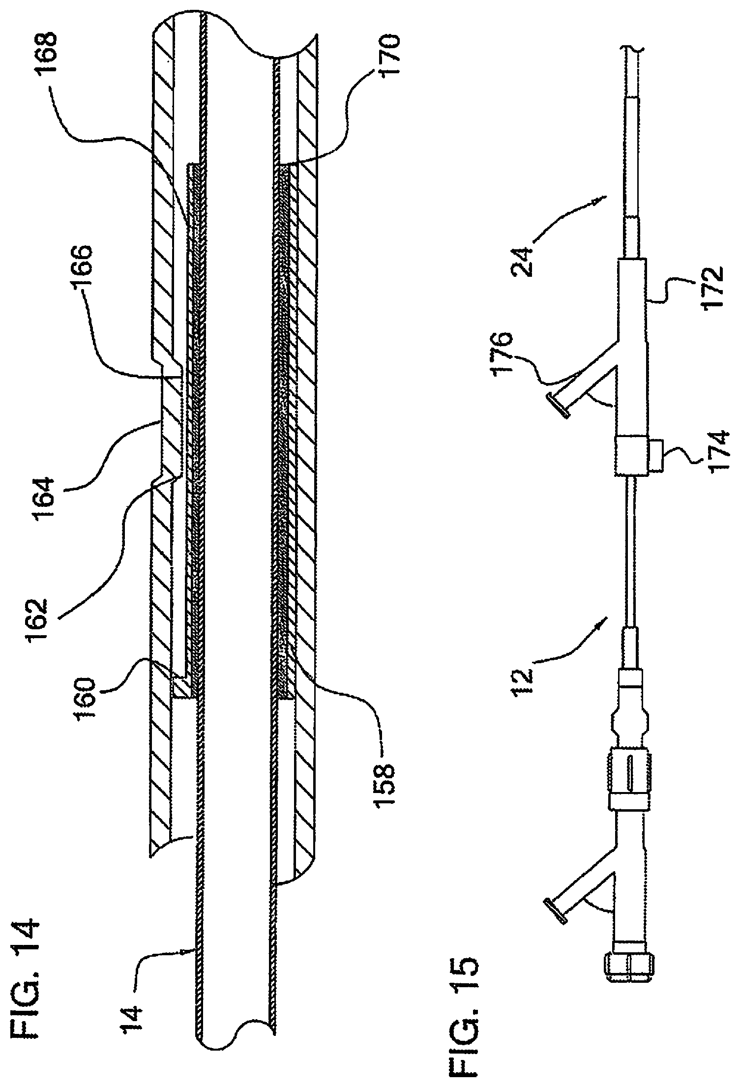 Patent US12090285 Figure 10 – Coaxial bi-directional catheter