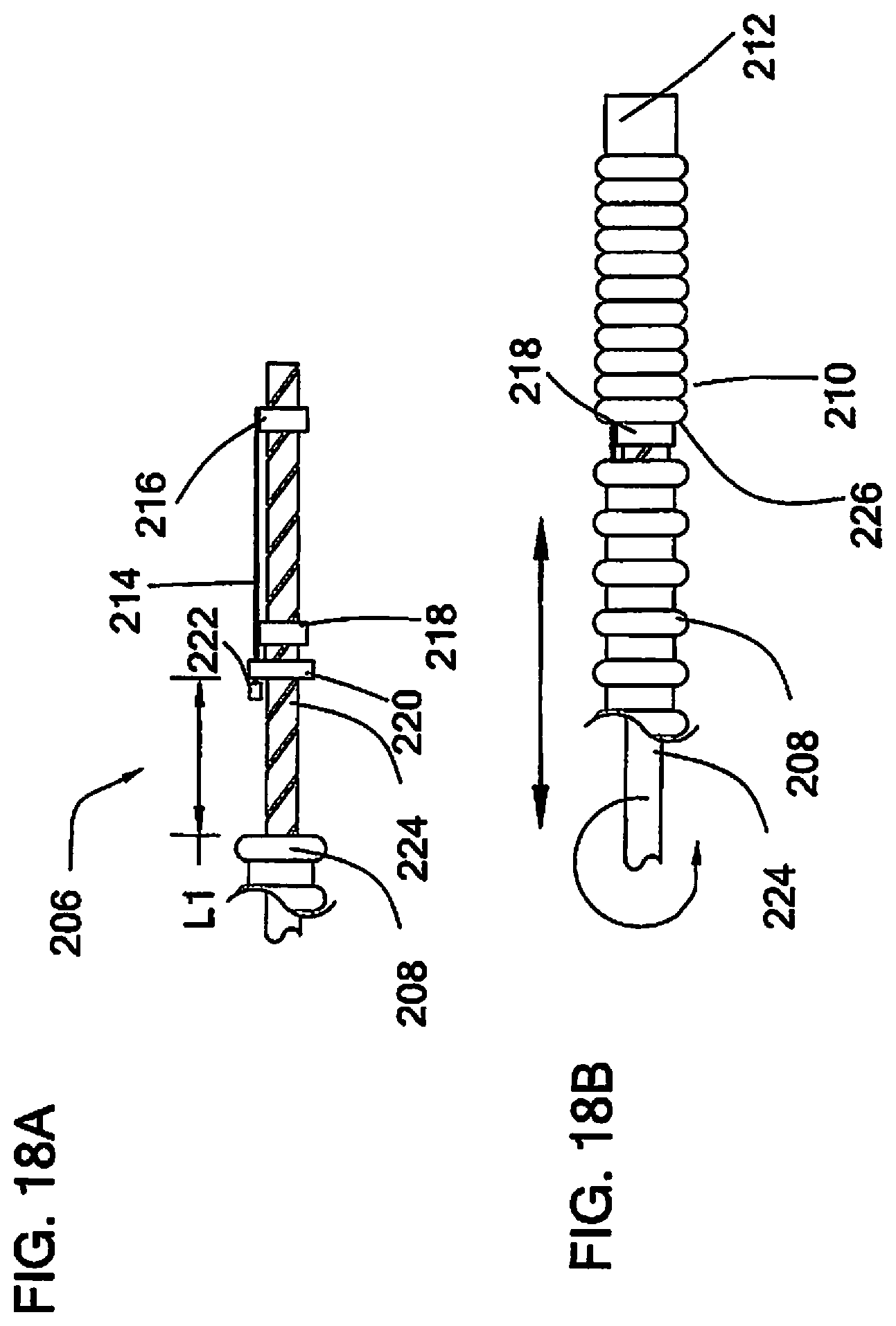 Patent US12090285 Figure 12 – Coaxial bi-directional catheter