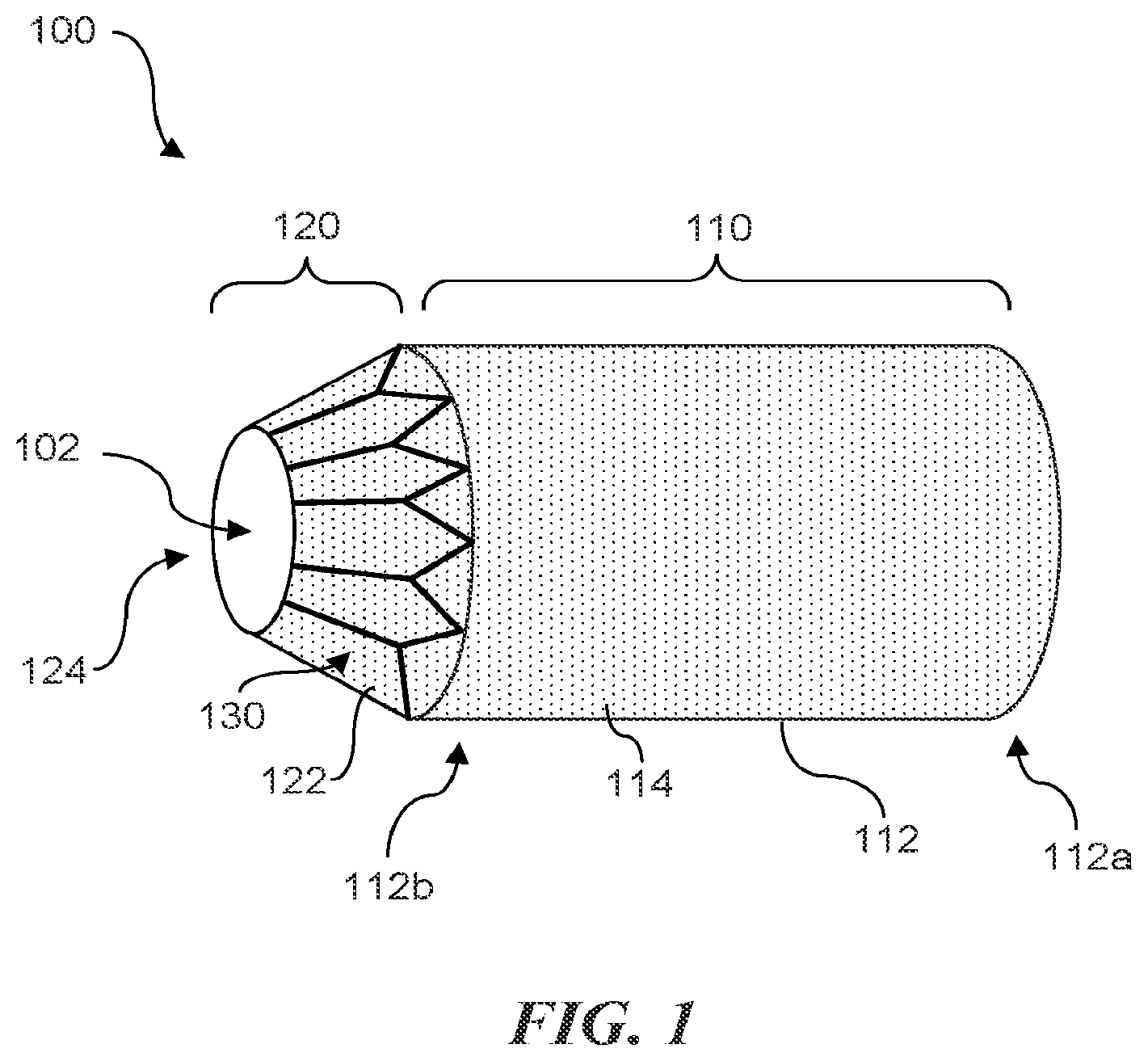 Patent US12090290 — Shape memory actuators for adjustable shunting systems, and associated systems and methods — Figure 1