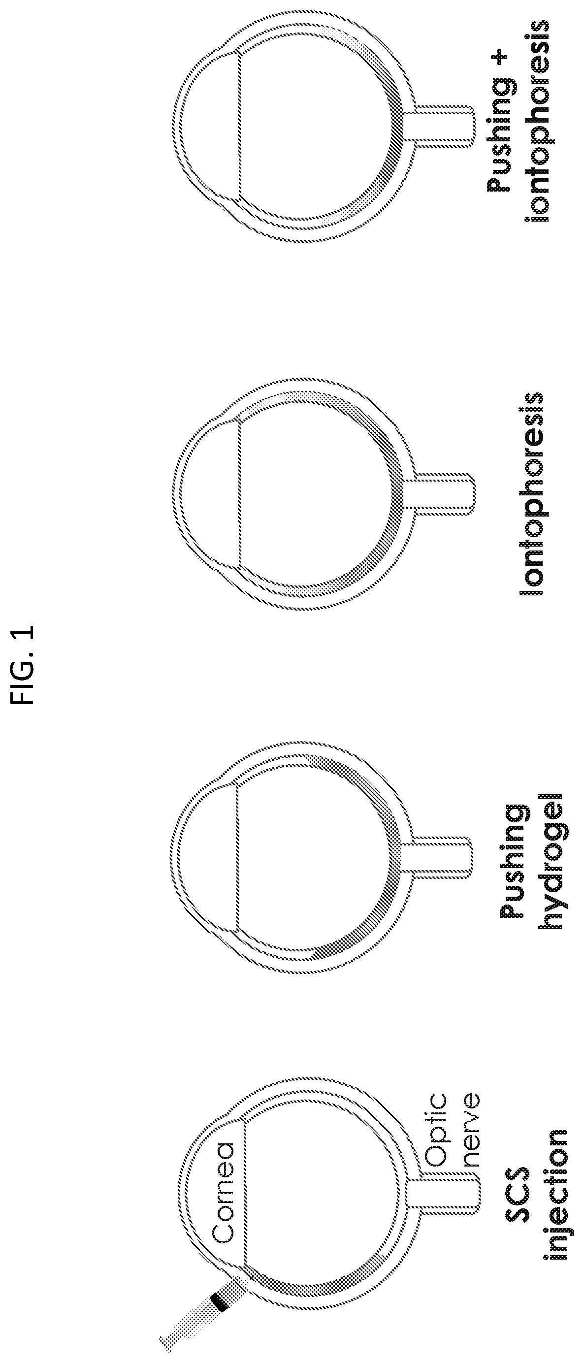 Patent US12090294 — Targeted drug delivery methods using a microneedle — Figure 1