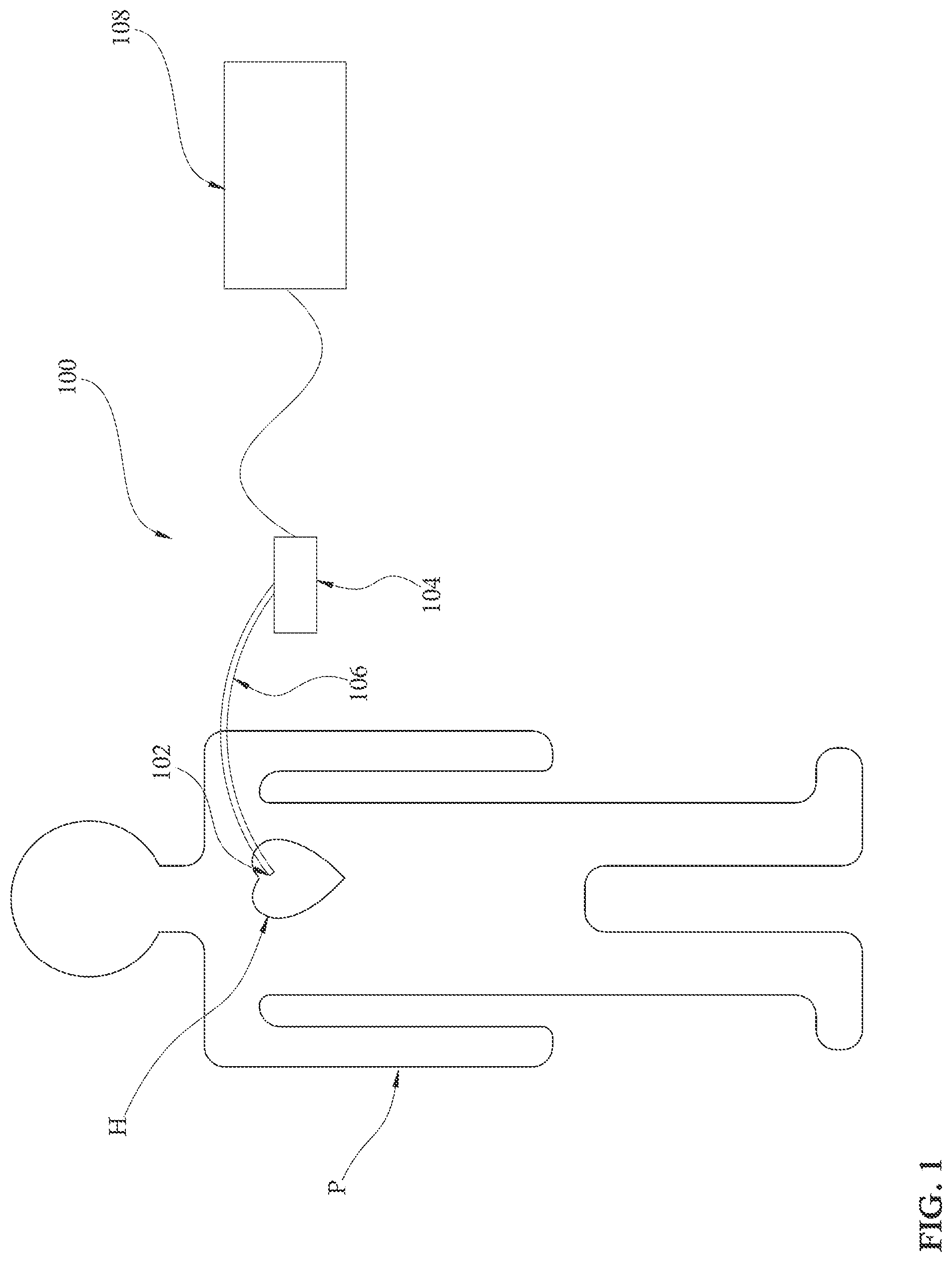 Patent US12090313 — Expandable mechanical hemodynamic support systems, devices, and methods — Figure 1