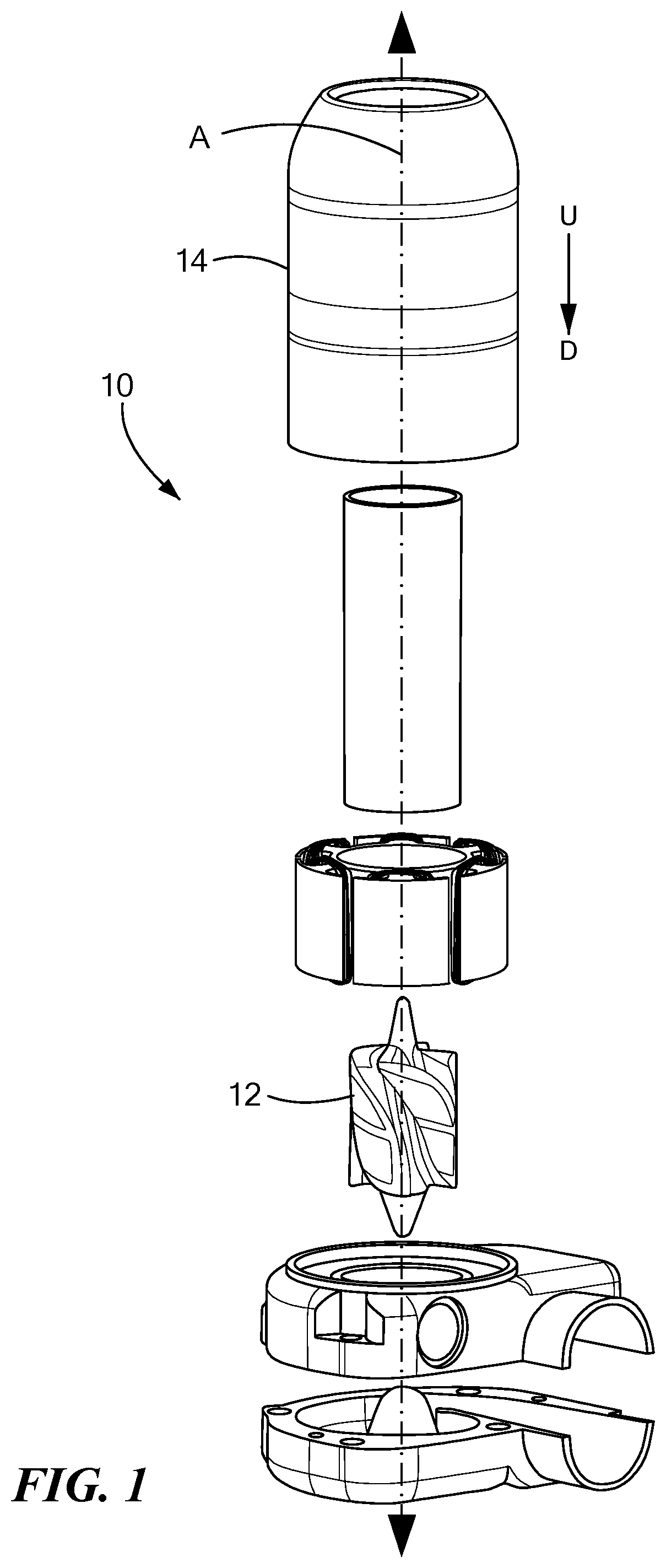 Patent US12090315 Figure 1 – Speed change algorithm to resolve suction conditions in LVADS