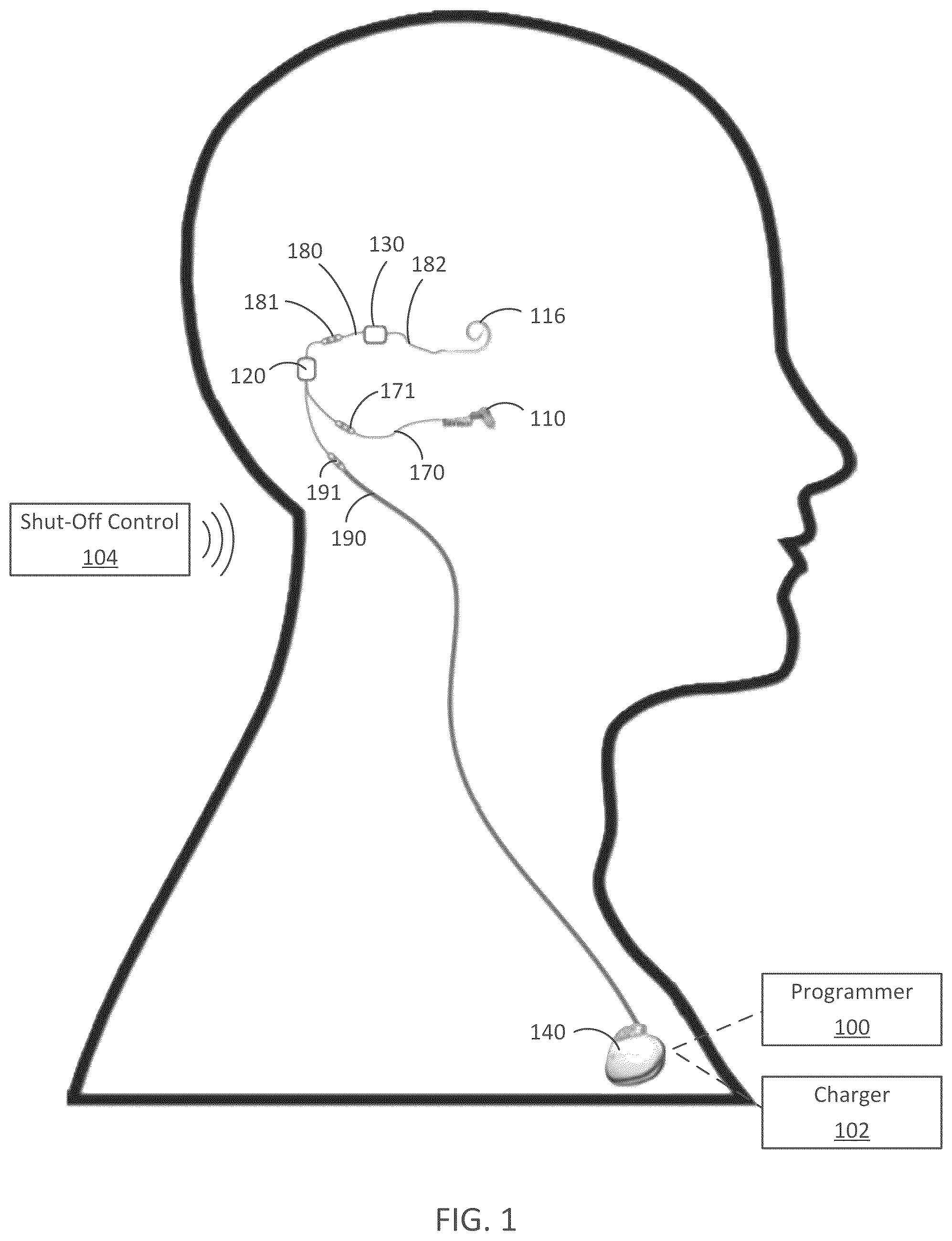 Patent US12090318 — Implantable cochlear system with integrated components and lead characterization — Figure 1