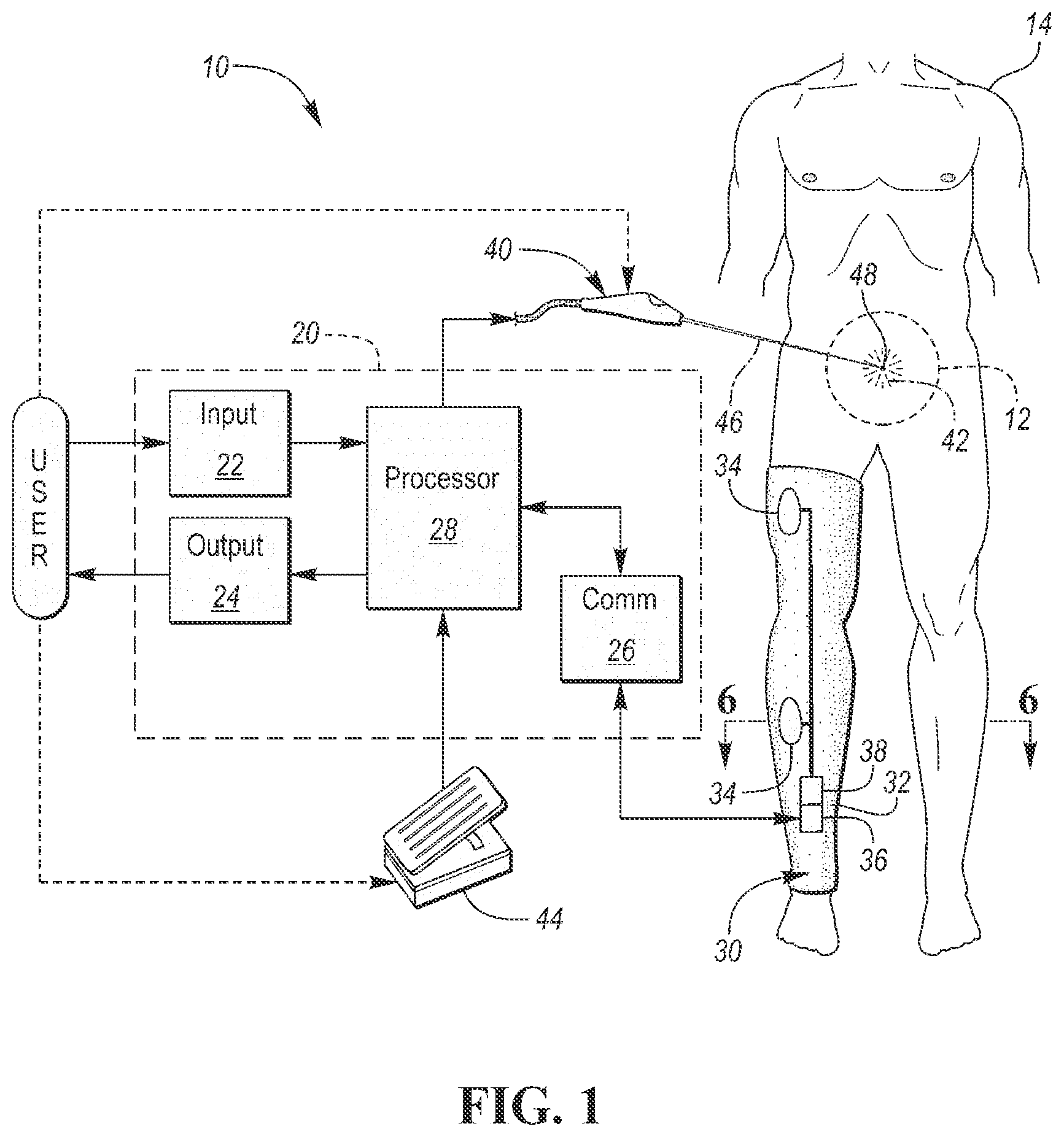 Patent US12090320 Figure 1 – Neuromuscular sensing device with multi-sensor array